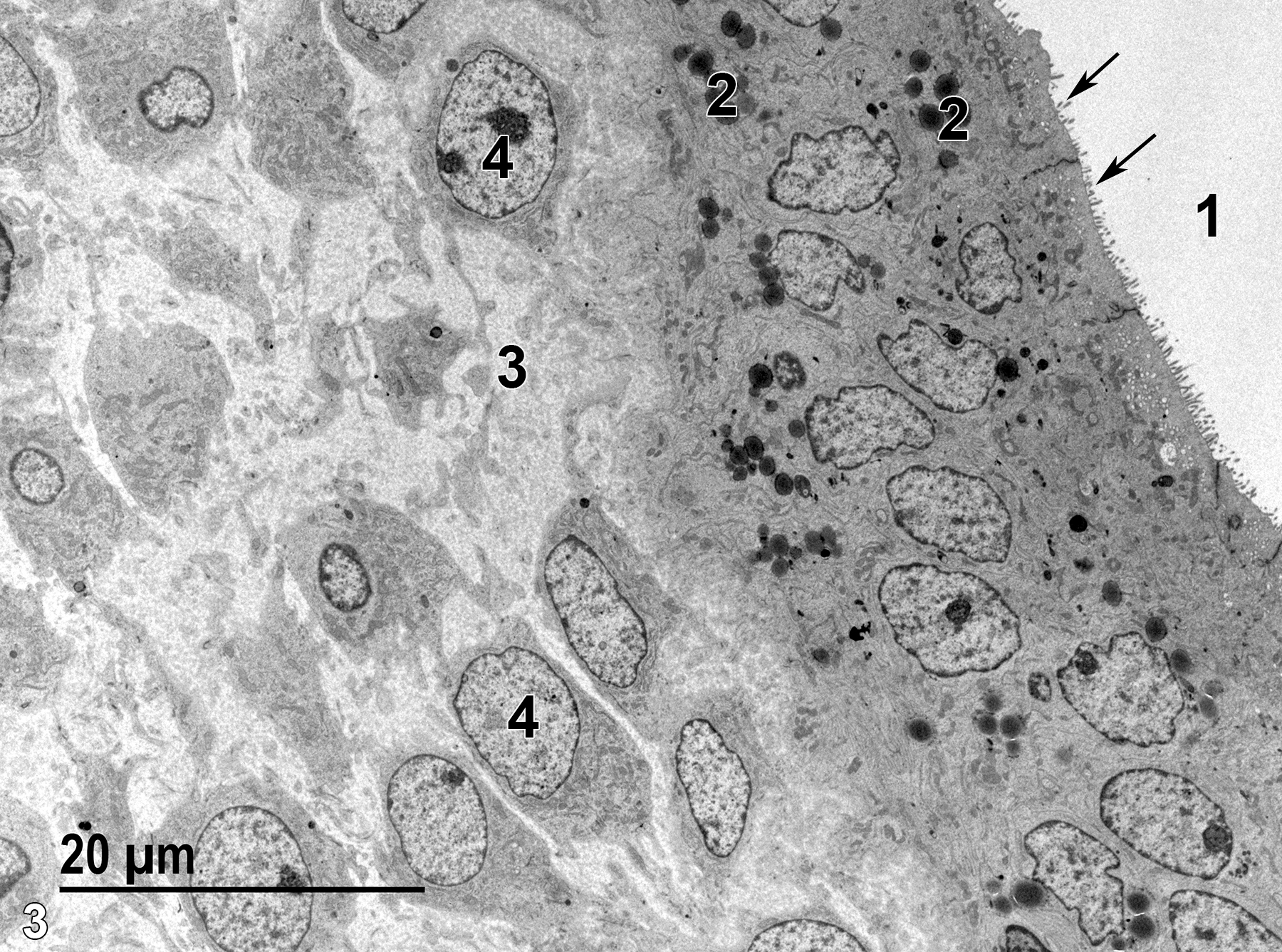 <strong>Figure 3.</strong> A low magnification electron micrograph from an area comparable to Figure 1. The uterine lumen (1) is lined with cuboidal epithelial cells with microvilli on the luminal side (arrows). The cells also contain electron-dense secretory granules (2). The stromal layer is filled with connective tissue (3) produced by fibroblasts (4). 1900x.