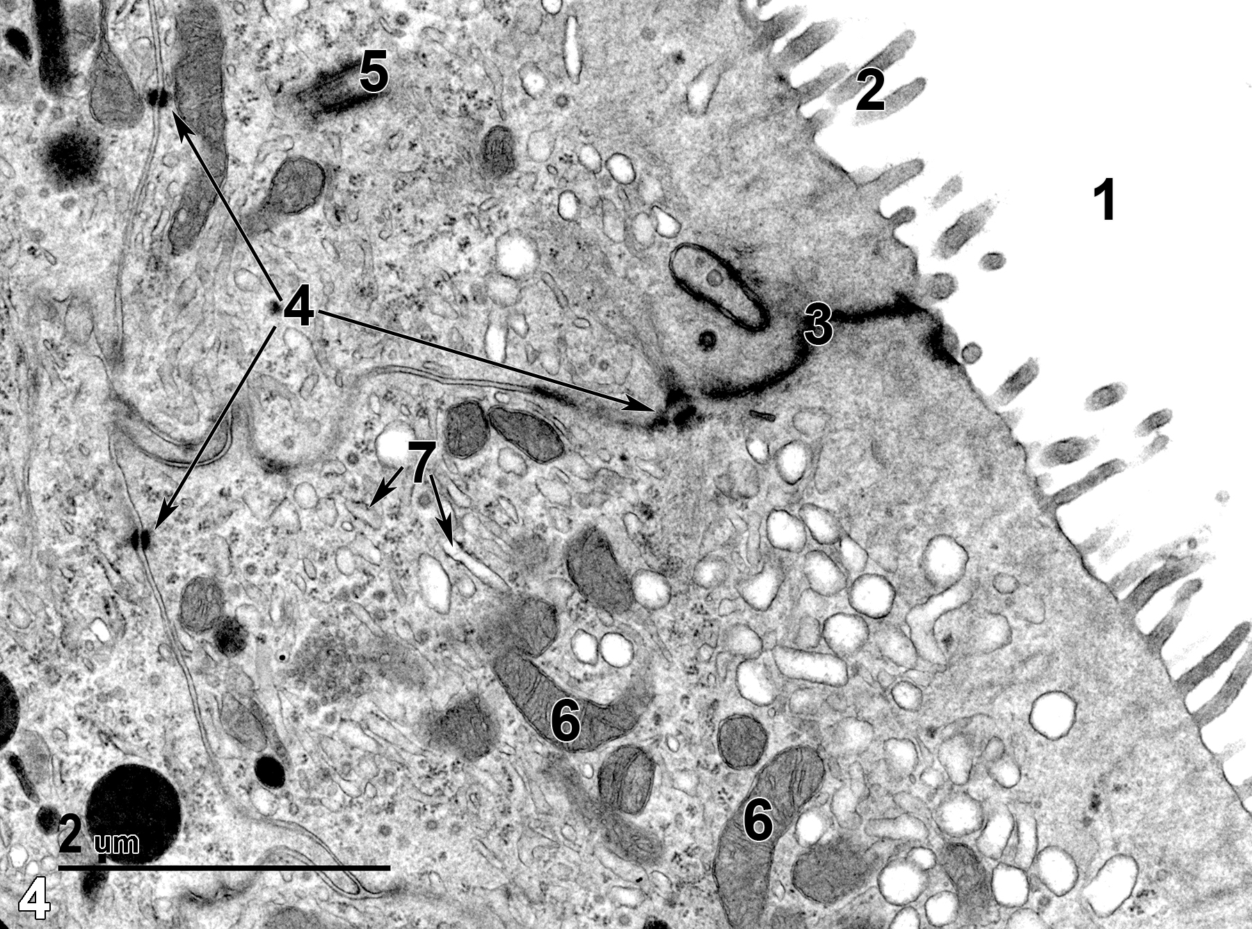 <strong>Figure 4.</strong> A higher magnification view of an epithelial cell, with microvilli (2) extending into the uterine lumen (1), a long junctional complex (3), and desmosomes (4) holding adjacent epithelial cells together (arrows). A single centriole (5) is present, as well as a number of mitochondria (6) and rough endoplasmic reticulum elements (7, arrows). 18500x.