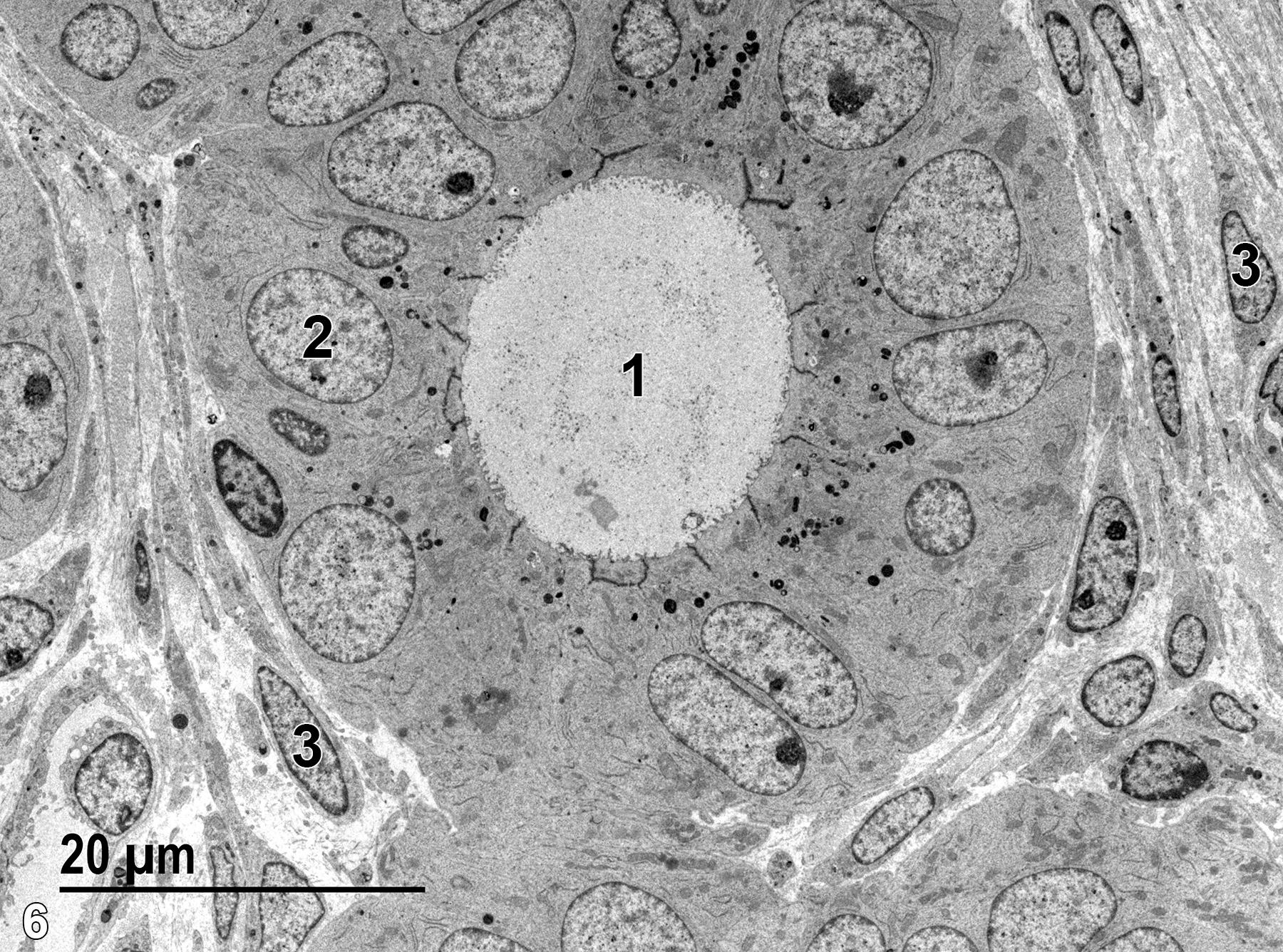 <strong>Figure 6.</strong> A uterine gland with cuboidal epithelial cells (2). The epithelial cells have microvilli extending into the glandular lumen (1) and electron-dense apical secretory granules. The electron-dense linear structures at the apical end of the glandular epithelial cells are junctional complexes. Connective tissue, which is composed of collagen and elastin fibrils and numerous fibroblasts (3), surrounds the gland. 1900x.