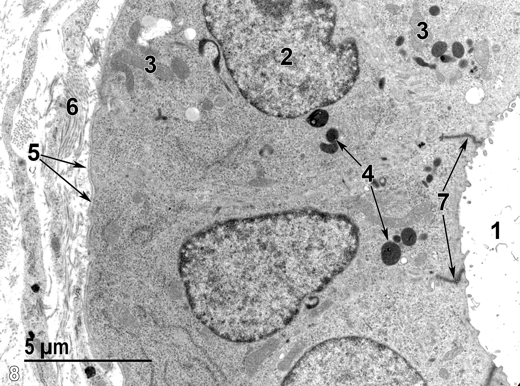 <strong>Figure 8.</strong> A higher magnification view of a uterine gland showing the glandular lumen (1) lined by epithelial cells (2) with short microvilli. The cells have pleomorphic mitochondria (3), apical secretory granules (4, arrows), and a basal lamina on the cell surface (5, arrows) adjacent to the surrounding collagenous matrix (6). The epithelial cells are connected by junctional complexes (7) at their apical surfaces (arrows). 6800x.