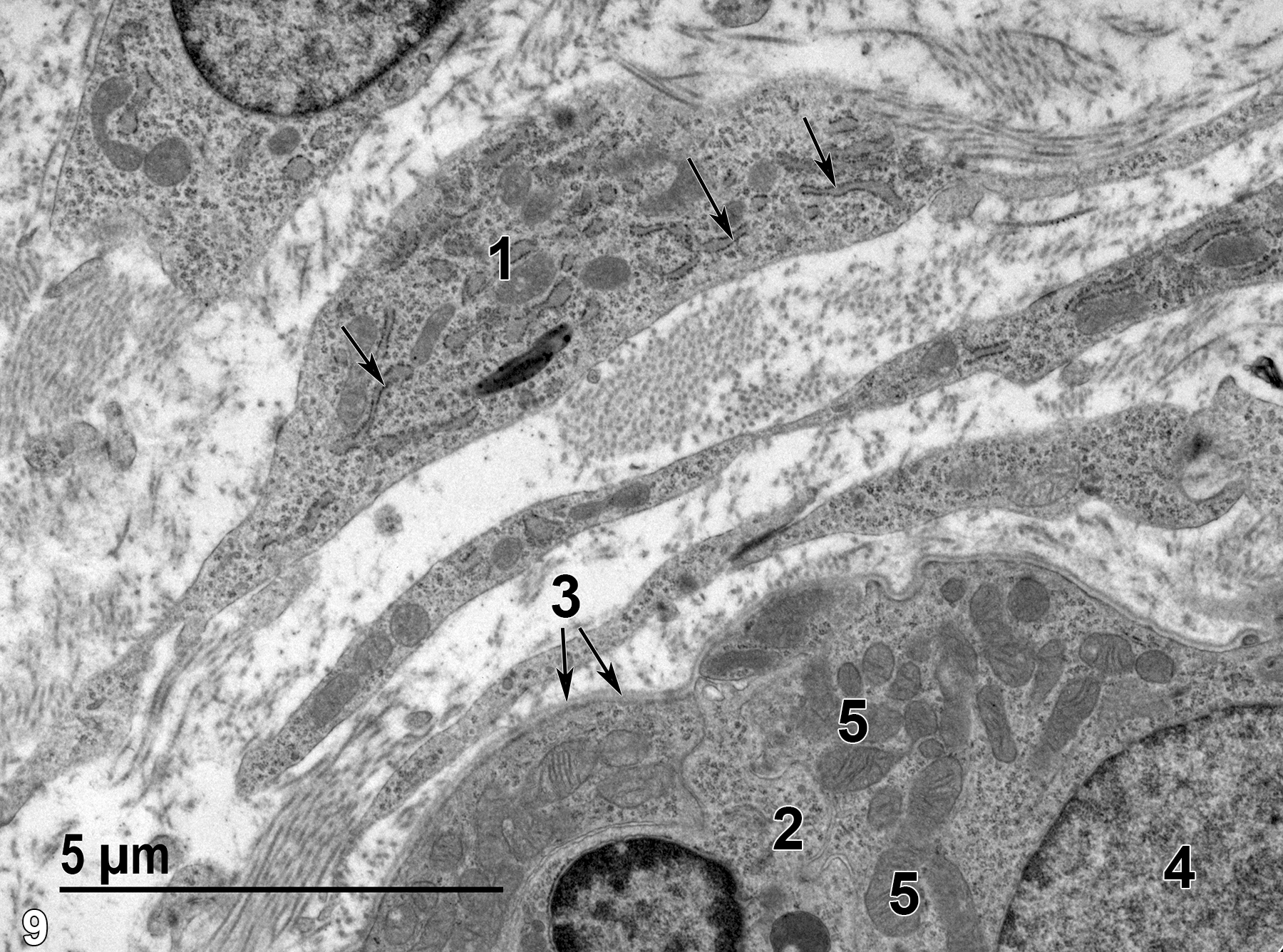 <strong>Figure 9.</strong> An area at the border of the sub-epithelium (stroma) and the muscularis layer. One of several fibroblasts (1) shows the three major characteristics of this cell type: large amounts of rough endoplasmic reticulum (arrows); an elongate cellular profile; and no basal lamina. A single smooth muscle cell (2) of the muscularis is shown. It has a basal lamina (3, arrows), a single nucleus (4), and a relative paucity of rough endoplasmic reticulum. A number of mitochondria (5) are evident. Collagen fibrils can be seen among the two cell types. 9300x.