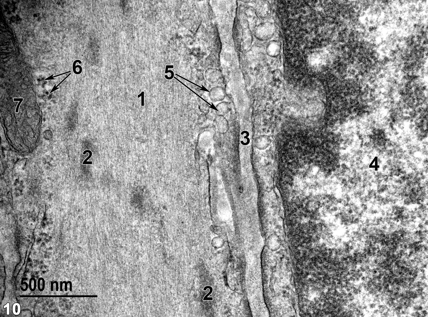<strong>Figure 10.</strong> A relatively high magnification view of two adjacent smooth muscle cells. Actin and myosin filaments (1) comprise the proteinaceous filaments seen in the cell to the left. Periodic dense bodies (2) are evident among the actin and myosin filaments. Basal lamina components (3) are located between the adjacent smooth muscle cells. The cell to the right in the image contains a nucleus (4) with marginated chromatin. Both cells have pinocytotic vesicles (5, arrows) near the cell membrane that are characteristic of smooth muscle cells. The cells also contain scattered ribosomes (6, arrows) and a mitochondrion (7). 49000x.