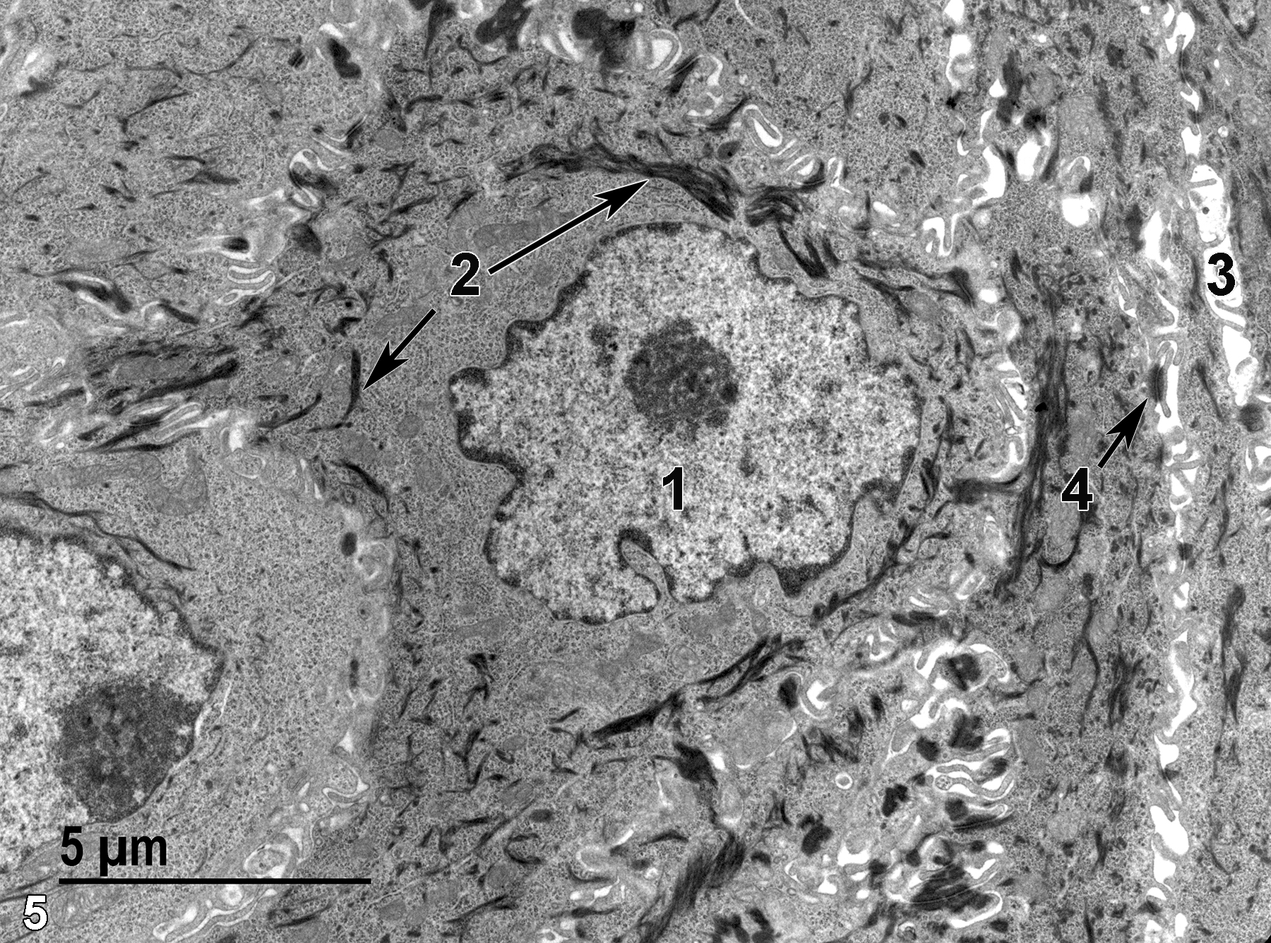 <strong>Figure 5.</strong> A high magnification view of epithelial cells of the mucous membrane. A nucleus of an epithelial cell (1) contains a single nucleolus, marginated chromatin, and has a slightly crenelated surface. Numerous bundles of tonofilaments (2, arrows) are present. The intercellular space (3) is filled with thin cytoplasmic extensions. Desmosomes (4, arrow) serve as attachment points between adjacent cells. 6800x.