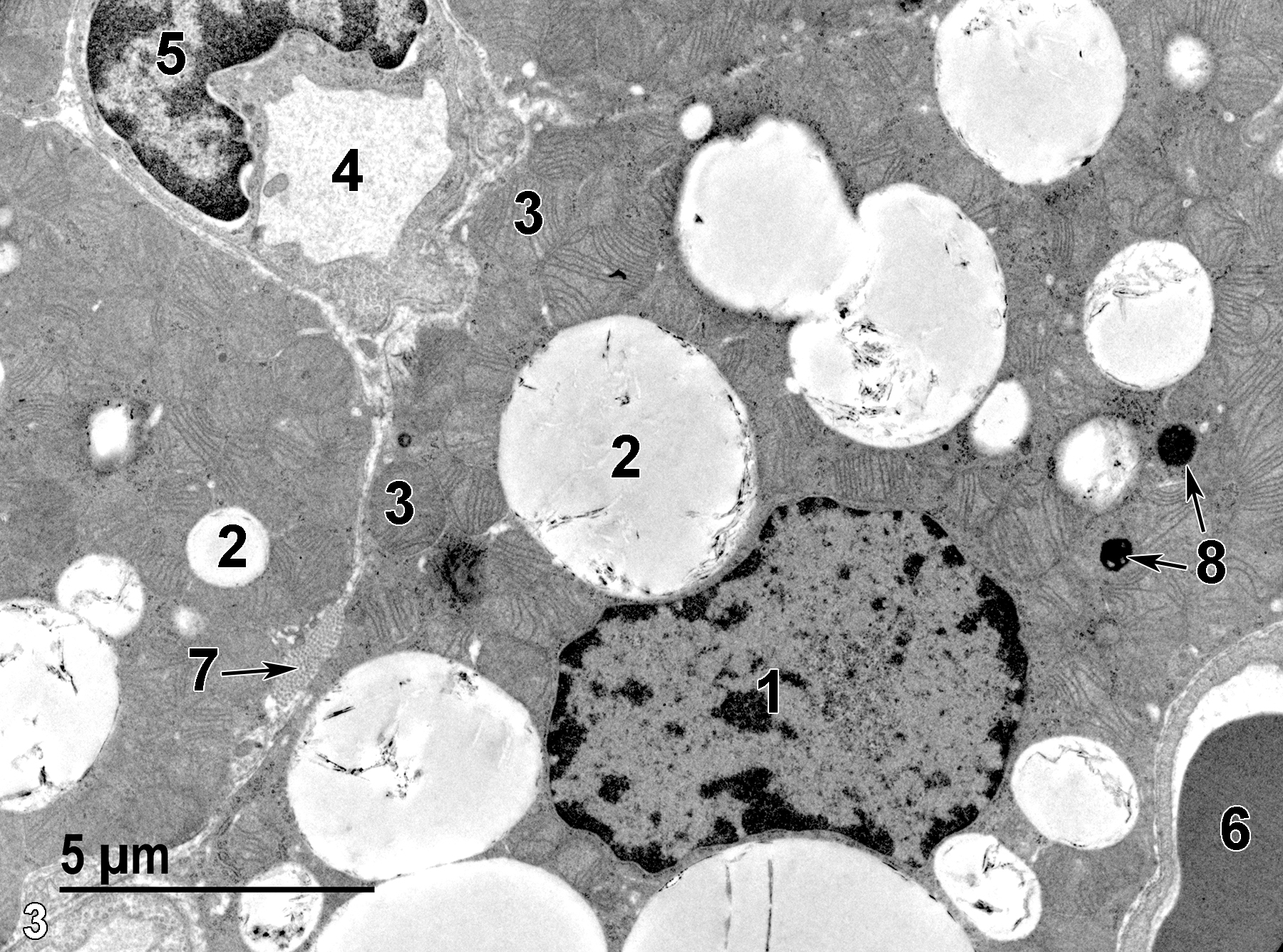 <strong>Figure 3.</strong> A higher magnification of chief cells showing a single nucleus (1) with marginated heterochromatin, lipid bodies of variable size (2), and numerous mitochondria (3). Endothelial cells, with a single visible nucleus (5) line a capillary lumen (4). Another capillary contains an erythrocyte (6). The capillaries are in the septa, along with collagen bundles (7, arrow). Two lysosomes are present in the cytoplasm of one of the chief cells (8, arrows). 6800x.
