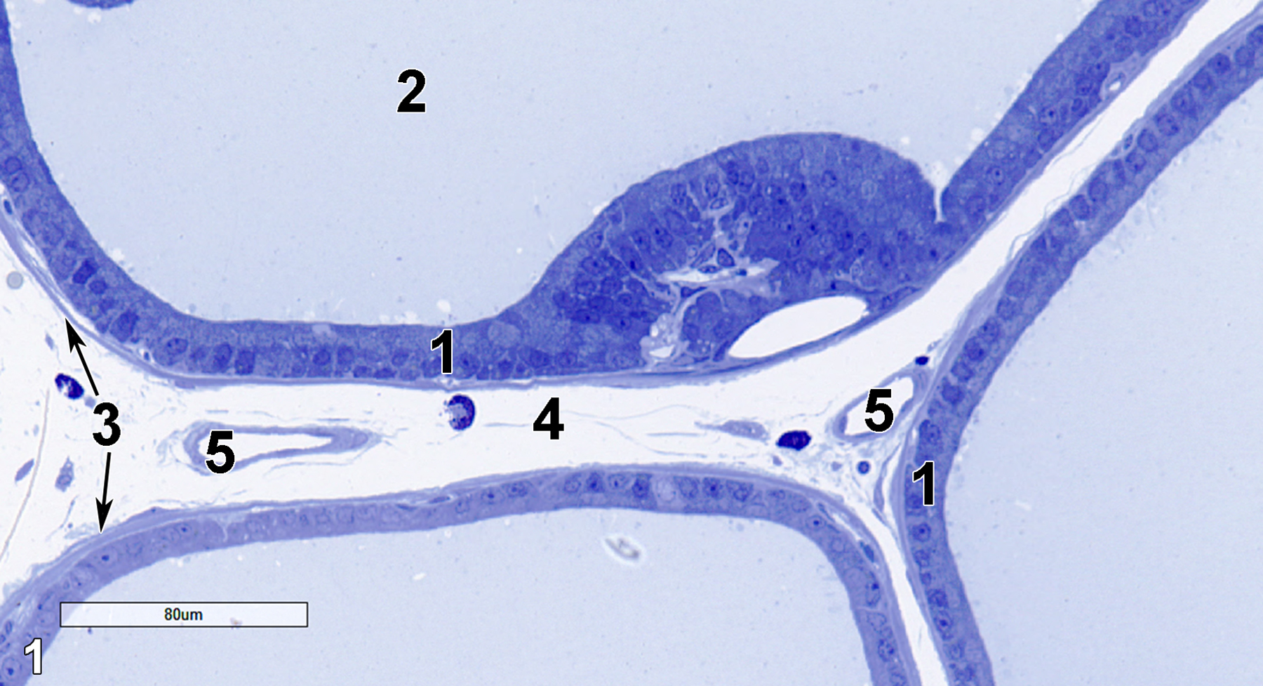 <strong>Figure 1.</strong> A semithin section (0.5 micrometer thick) of a toluidine blue O-stained portion of the dorsolateral part of the prostate gland. A tall columnar epithelial portion (1) lines the alveolar lumen (2). The stroma consists of a thin layer of smooth muscle cells beneath the epithelial cell layer (3, arrows) and loose connective tissue (4) with several blood vessels (5). 25x.