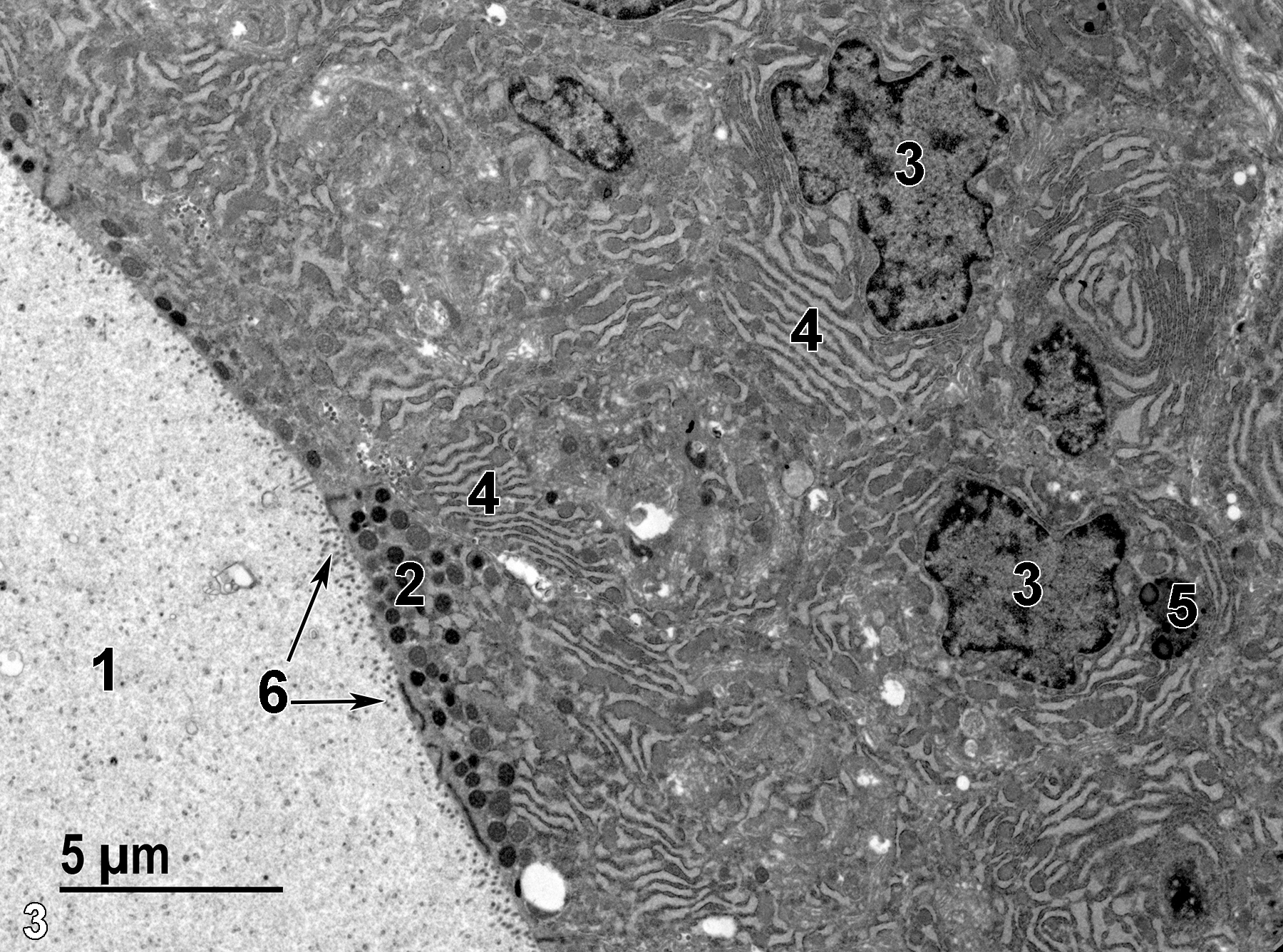 <strong>Figure 3.</strong> A higher magnification view of dorsolateral lobe alveolar epithelial cells. Note the finely granular secretory material in the alveolar lumen (1), the apical secretory granules (2), the basal nuclei (3), the large stacks of rough endoplasmic reticulum (4), a lysosome (5), and microvilli (6, arrows) on the apical surface of the epithelial cells. 4800x.