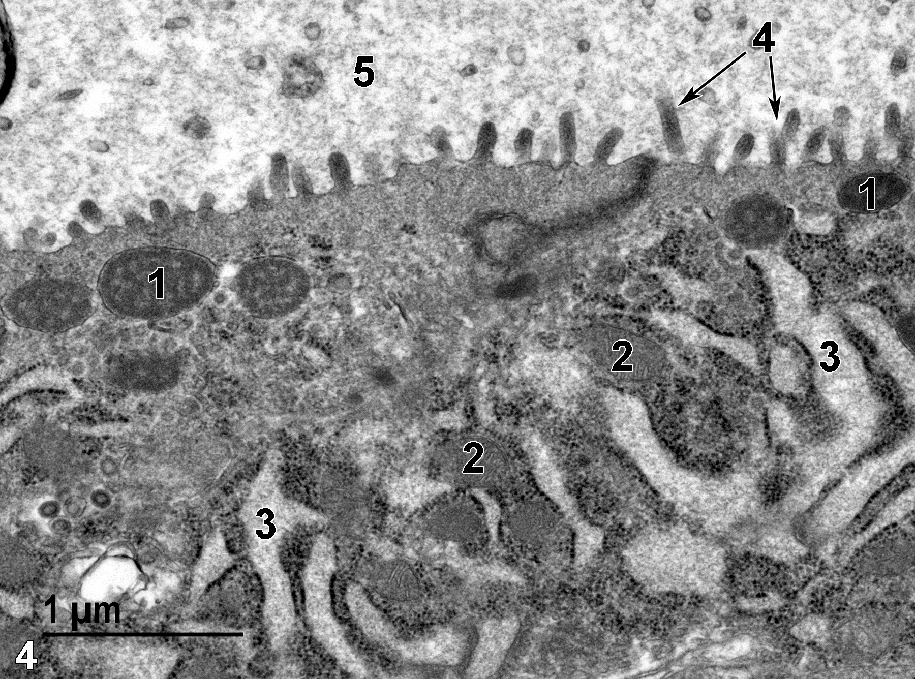 <strong>Figure 4.</strong> An even higher magnification image of the surface of a dorsolateral lobe alveolar epithelial cell. Several secretory granules (1) are present, along with a number of mitochondria (2) intermixed with the rough endoplasmic reticulum cisternae (3). Microvilli (4, arrows) line the alveolar lumen (5), which contains finely granular secretory material. 30000x.