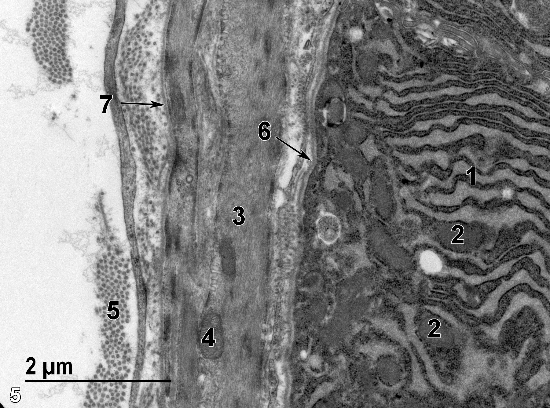 <strong>Figure 5.</strong> A high magnification of the base of an alveolar epithelial cell with stacks of rough endoplasmic reticulum (1) intermixed with mitochondria (2). The underlying smooth muscle cells of the stroma contain large amounts of actin and myosin filaments (3) and a few mitochondria (4). The collagen in the stromal tissue (5) is seen in dense clusters. A thin basal lamina is located at the base of the epithelial cells of the alveolus (6, arrow). In addition, a thin basal lamina (7, arrow) surrounds the smooth muscle cells. 18500x.