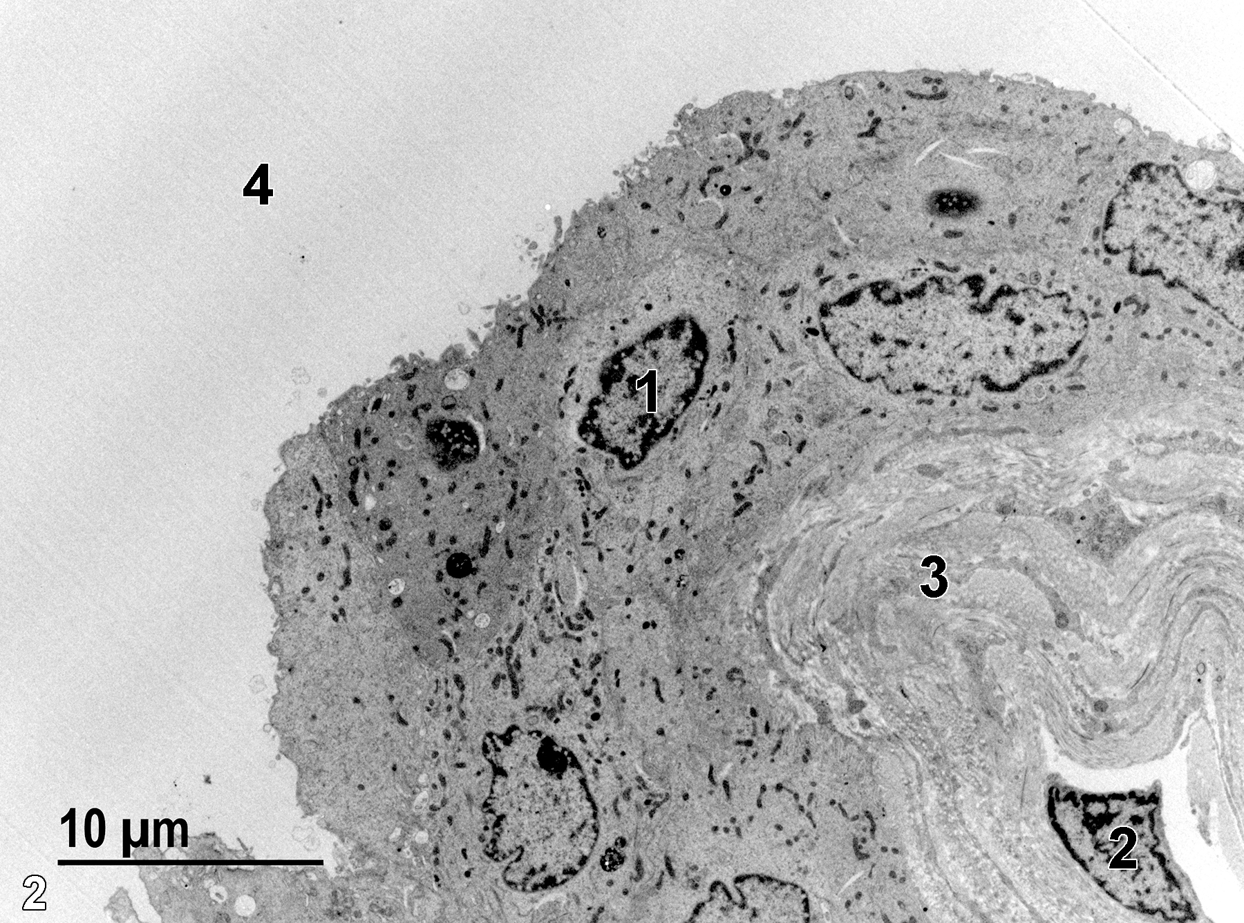<strong>Figure 2.</strong> An ultrathin section of the bladder epithelium and underlying submucosal layer. An epithelial cell nucleus (1) has marginated heterochromatin, and some of the nuclei in the epithelial cell layer have crenelated borders. In the submucosa, a single fibroblast cell nucleus (2) is present within the mass of collagen (3), consisting of the bulk of the submucosa. The surface of the mucosa extends into the bladder lumen (4). 2900x.