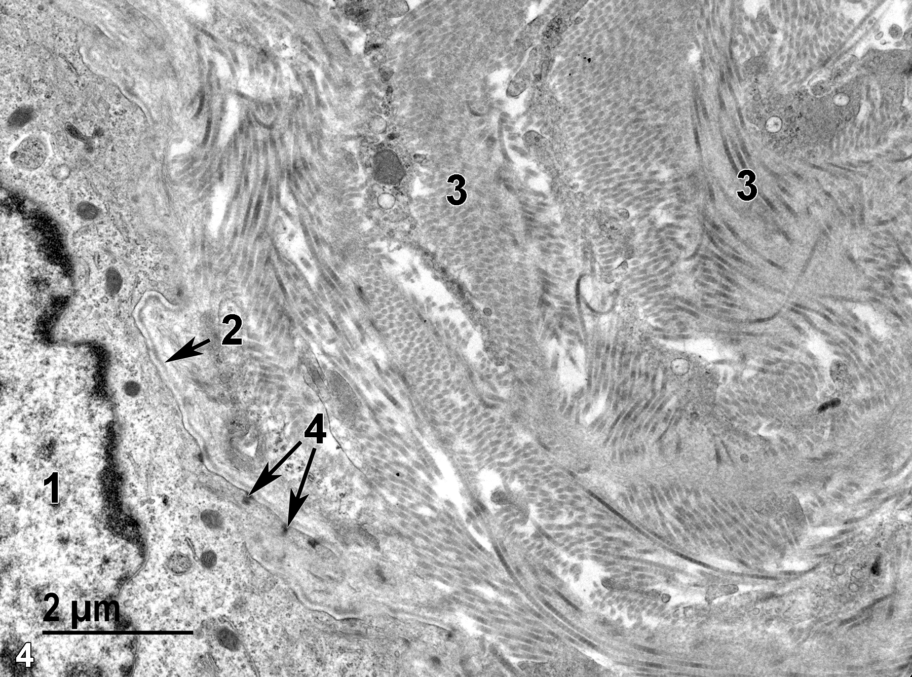 <strong>Figure 4.</strong> The nucleus (1) of one of the basal epithelial cells of the mucosa. Separating the epithelial cells from the submucosal layer that contain characteristic collagen fibrils (3) is a thin basal lamina (2, arrow). Several hemi-desmosomes (4, arrows) in the basal aspect of the epithelial cell are oriented toward the basal lamina. 11000x.