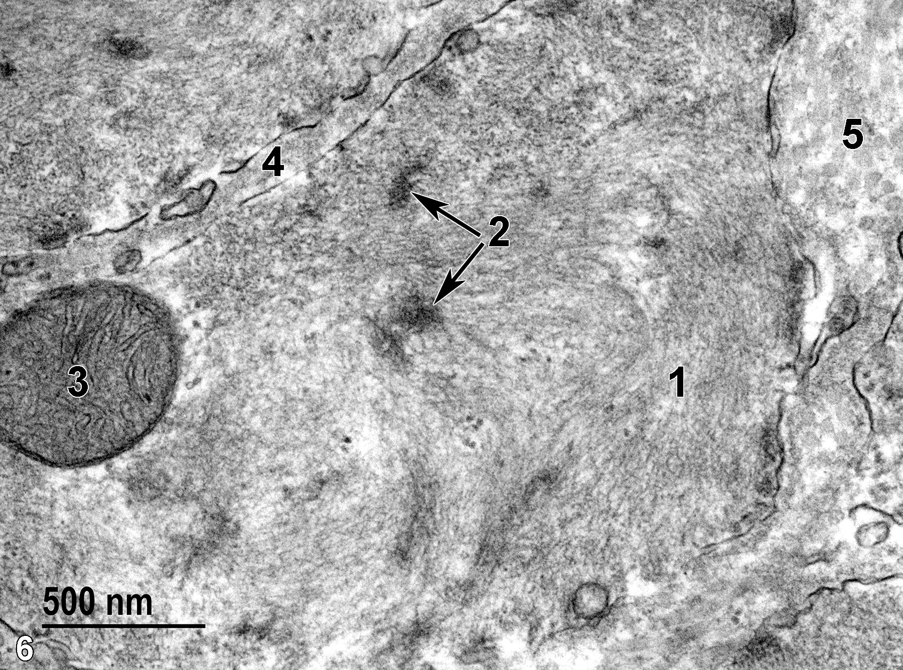<strong>Figure 6.</strong> A high magnification view of a smooth muscle cell of the muscularis layer. Numerous contractile filaments of actin and myosin (1) fill the cytoplasm, along with dense bodies (2, arrows).A single mitochondrion (3) with prominent cristae and fairly electron-dense matrical content is present. Smooth muscle cell basal laminae (4) are present between the cells. Collagen fibrils (5) are located between smooth muscle cells in the muscularis layer. 49000x.