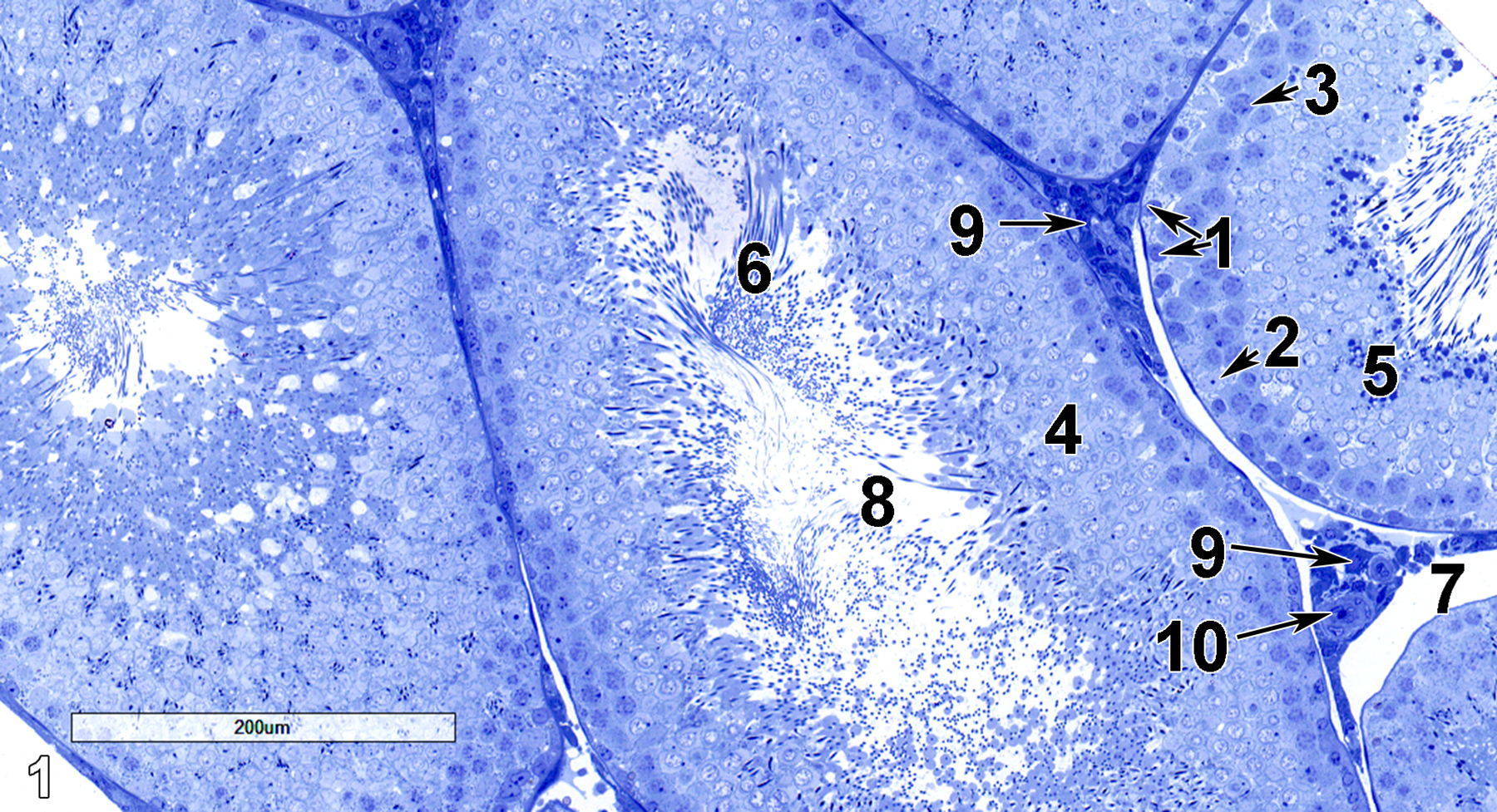<strong>Figure 1.</strong> A semithin section (0.5 micrometer thick) of a toluidine blue O-stained portion of a testis, showing several seminiferous tubules. Spermatogonia (1) with round nuclei (arrows) lie on the basal lamina underlain by the lamina propria. In lesser numbers are Sertoli cells (2), with larger, less stained nuclei (arrow). Primary spermatocytes (3) form several layers above the basal cell layers and have round, relatively dark nuclei (arrow). Early spermatids (4) have less dense and smaller nuclei than the primary spermatocytes lying beneath them. Late spermatids (5) have accumulations of densely staining material. Spermatozoa (6) have flagellar shafts extending into the seminiferous tubule lumen (8). The peritubular lymphatic space (7) is located between the seminiferous tubules, along with connective tissue, Leydig cells (9, arrow), and occasional lymphocytes (10, arrow). 13x.