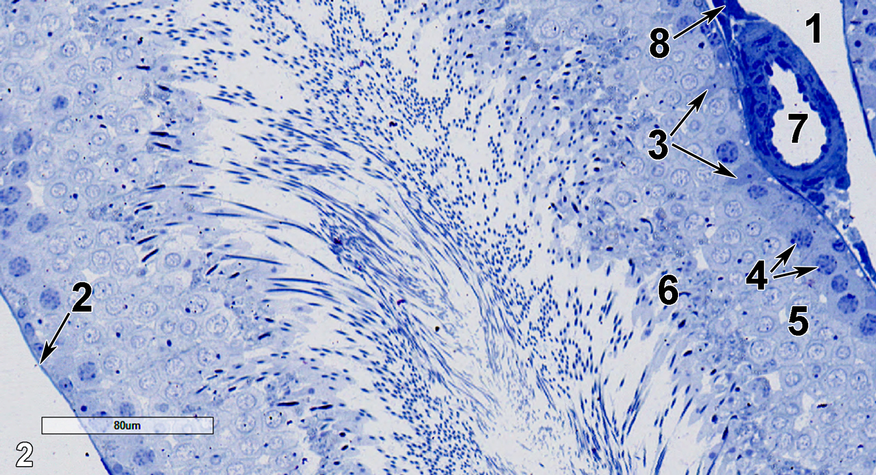 <strong>Figure 2.</strong> Another semithin section of a portion of a seminiferous tubule at slightly higher magnification. An interstitial lymphatic space (1) is next to an arteriole (7), which has an adjacent Leydig cell (8, arrow). Sertoli cells with relatively pale nucleoplasm (3, arrows) are adjacent to the lamina propria (2, arrow), as are the primary spermatocytes (4, arrows). Above the basal layer of cells are early spermatids (5), which lie beneath late spermatids (6) that contain dense staining material that eventually forms acrosomes. 25x.