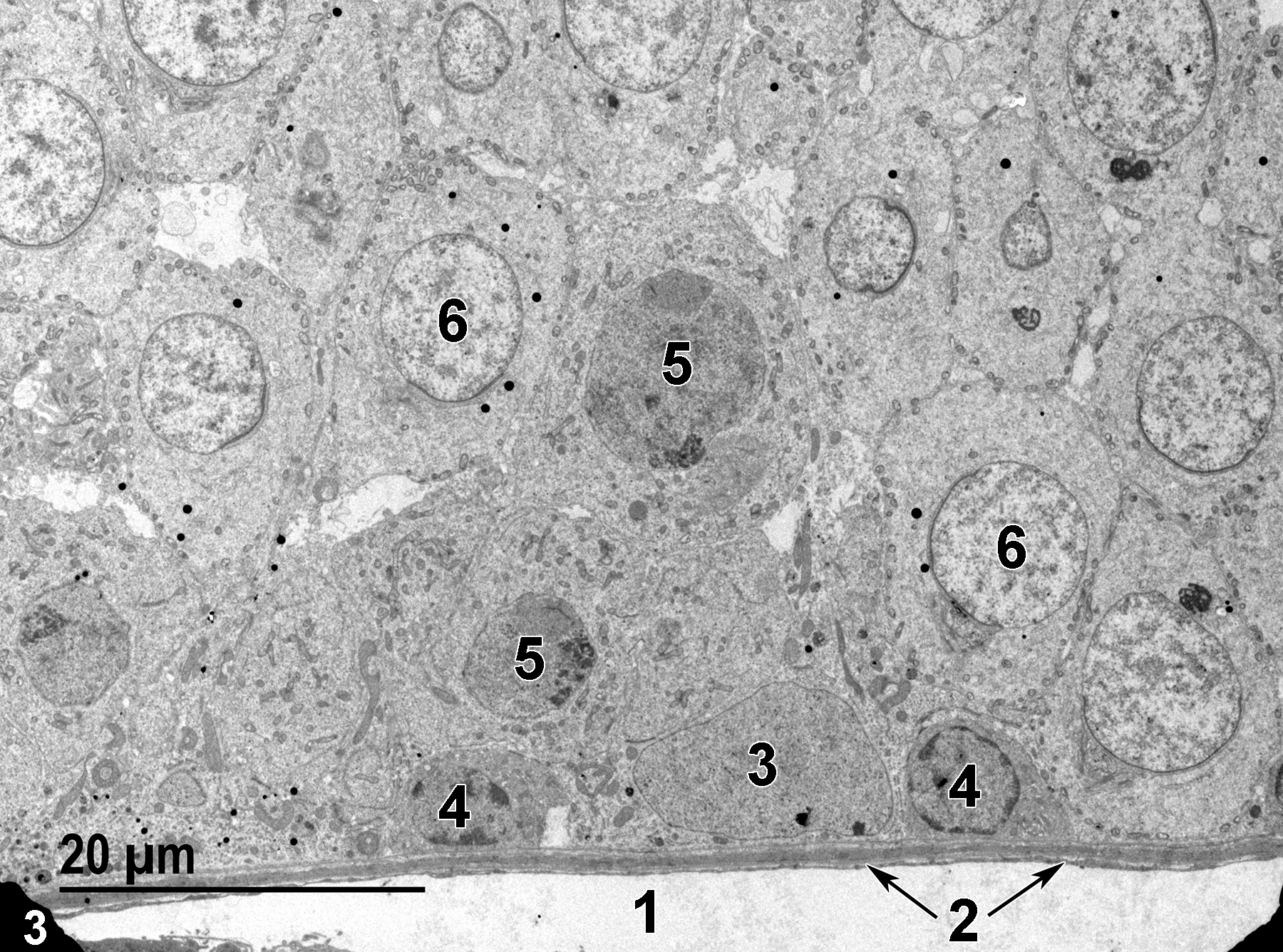 <strong>Figure 3.</strong> A low magnification electron micrograph of the basal region of a seminiferous tubule. The lamina propria is separated from the lumen of the peritubular lymphatic space (1) by a thin endothelial cell layer (2, arrows). A Sertoli cell with a large nucleus (3) and dispersed chromatin is sitting on the basal lamina of the seminiferous tubule. Type A spermatogonia with smaller, round nuclei (4) show marginated heterochromatin. Primary spermatocytes (5) have slightly more mitochondria than that of spermatogonia and are not located on the basal lamina. Early spermatids (6) are characterized by the numerous small mitochondria located along the plasma membrane and the relatively dispersed chromatin. 1900x.