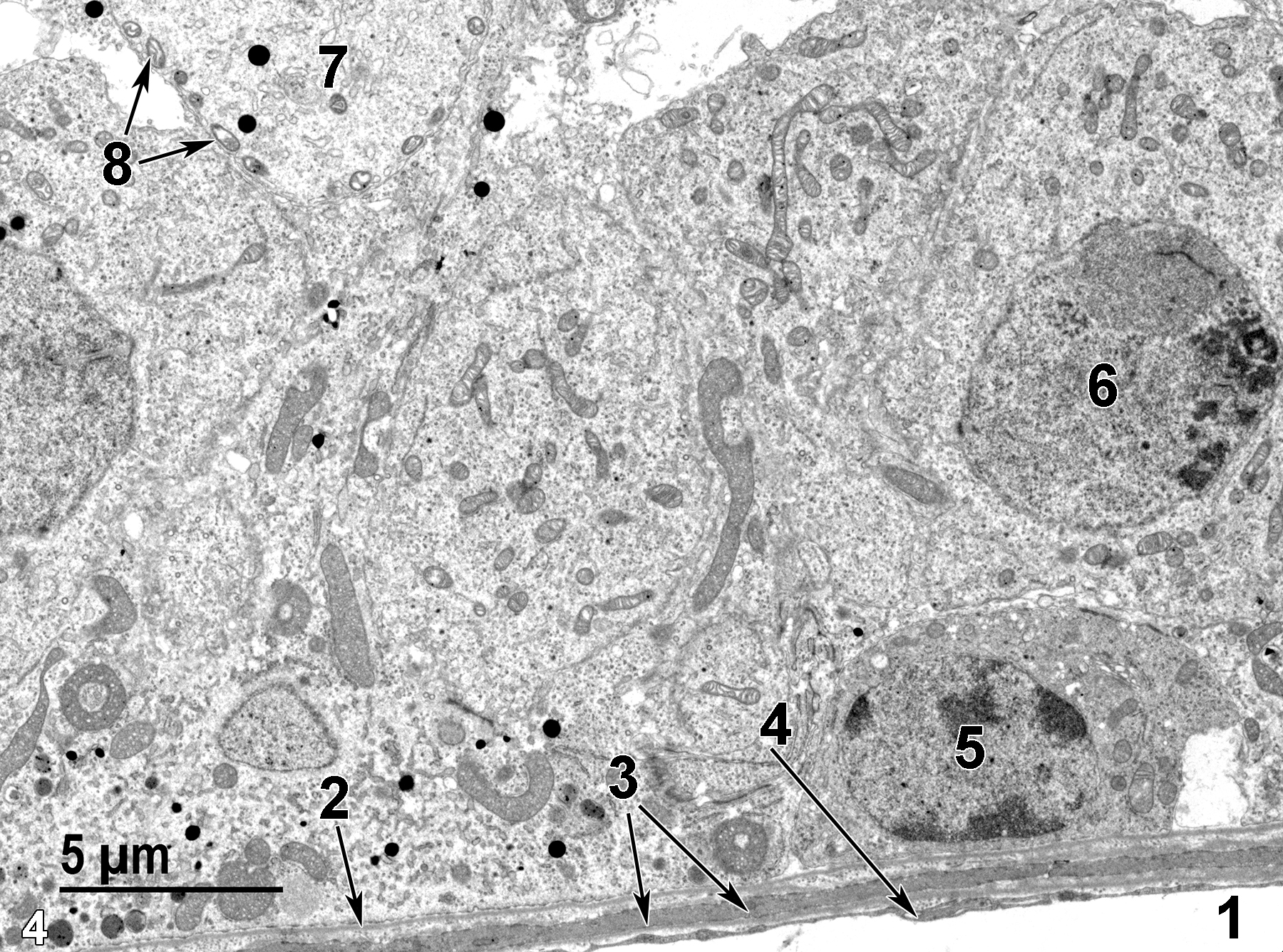 <strong>Figure 4.</strong> Another view of the basal region of a seminiferous tubule, showing the peritubular lymphatic space (1) lined with a thin endothelial cell layer (4, arrow). The base of the seminiferous tubule has a thin basal lamina (2, arrow) over a small band of connective tissue and a single layer of peritubular myoid cells (3, arrows). A single type A spermatogonium (5) is closely appressed to the basal lamina and contains an ovoid nucleus with marginated heterochromatin. Above the spermatogonium is a primary spermatocyte cell with a labeled nucleus (6). In the upper left of the image is a portion of an early spermatid (7) with its characteristic small mitochondria (8, arrows) arranged along the plasma membrane. 4800x.