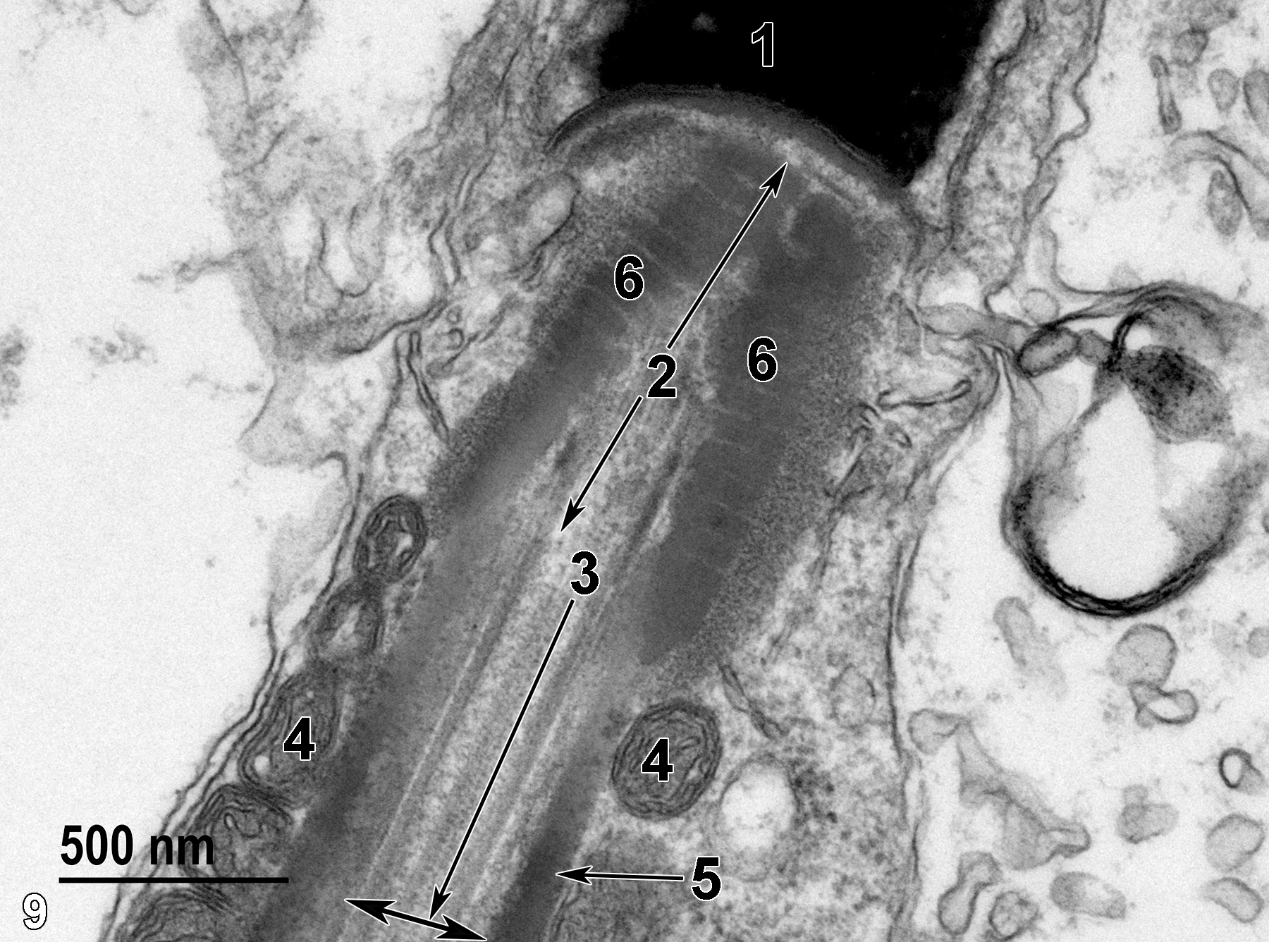 <strong>Figure 9.</strong> The region directly beneath Figure 8. The base of the nucleus (1) is adjacent to the neck region (2, arrows) with outer segmented rings of fibrous material (6) surrounding the axoneme that extends down the center of the spermatozoon. The beginning (3) of the middle piece (arrow) consists of the axoneme (two-headed arrow) surrounded by a relatively thin fibrous sheath (5, arrow), which is, in turn, surrounded by mitochondria (4). 49000x.