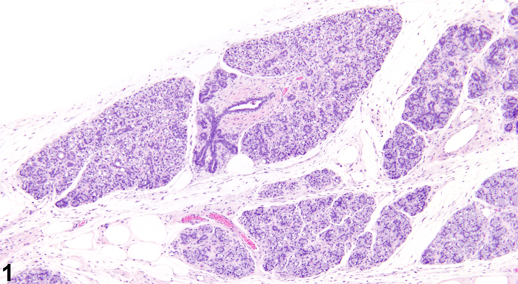 Image of lobular hyperplasia in the mammary gland of a female F344/N rat from a chronic study.