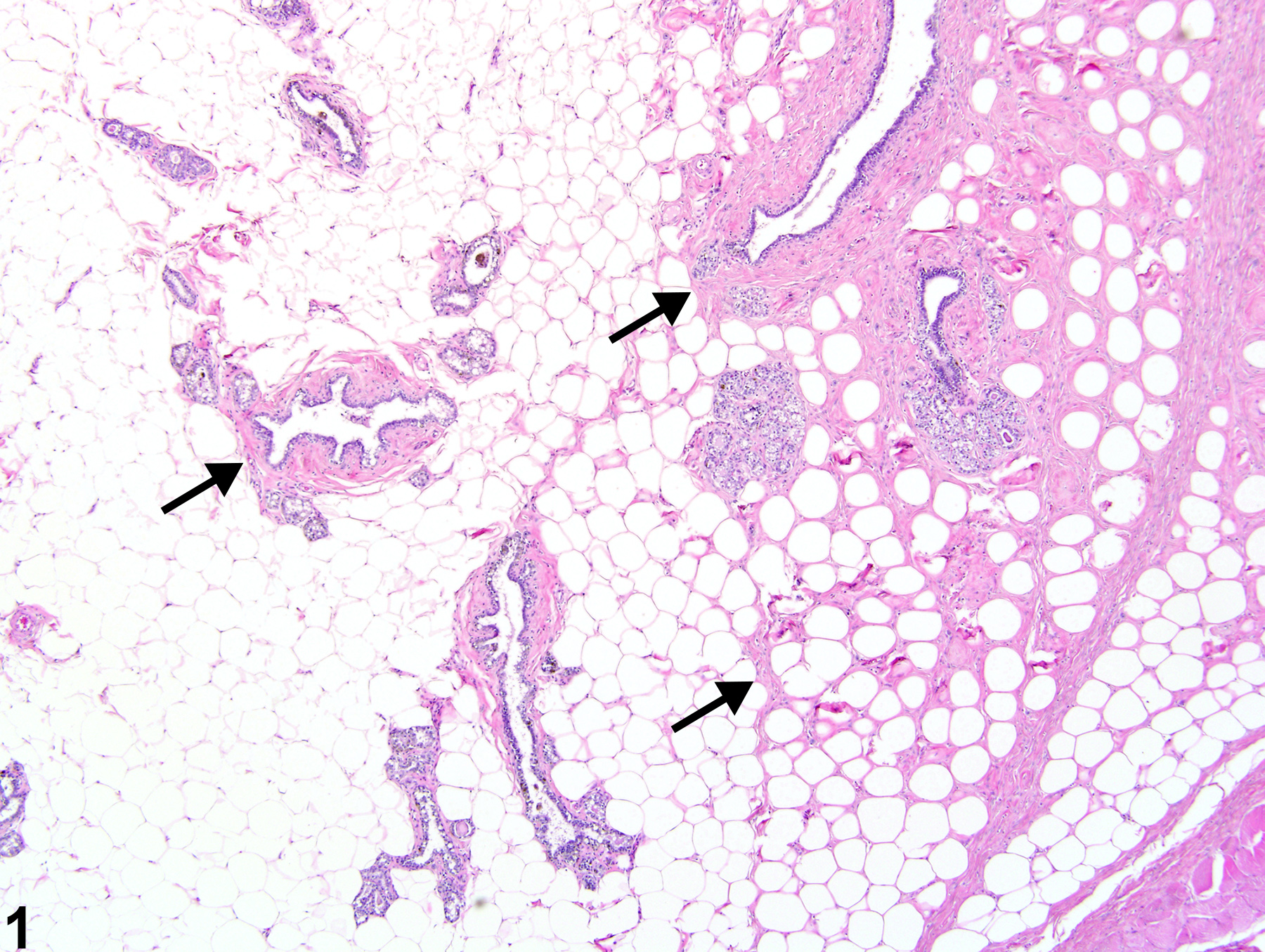 Image of fibrosis in mammary gland in a male F344/N rat from a chronic study.