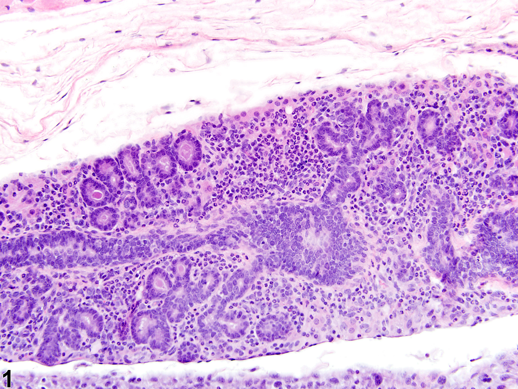 Image of inflammation, chronic active in a female B6C3F1/N mouse from a chronic study.