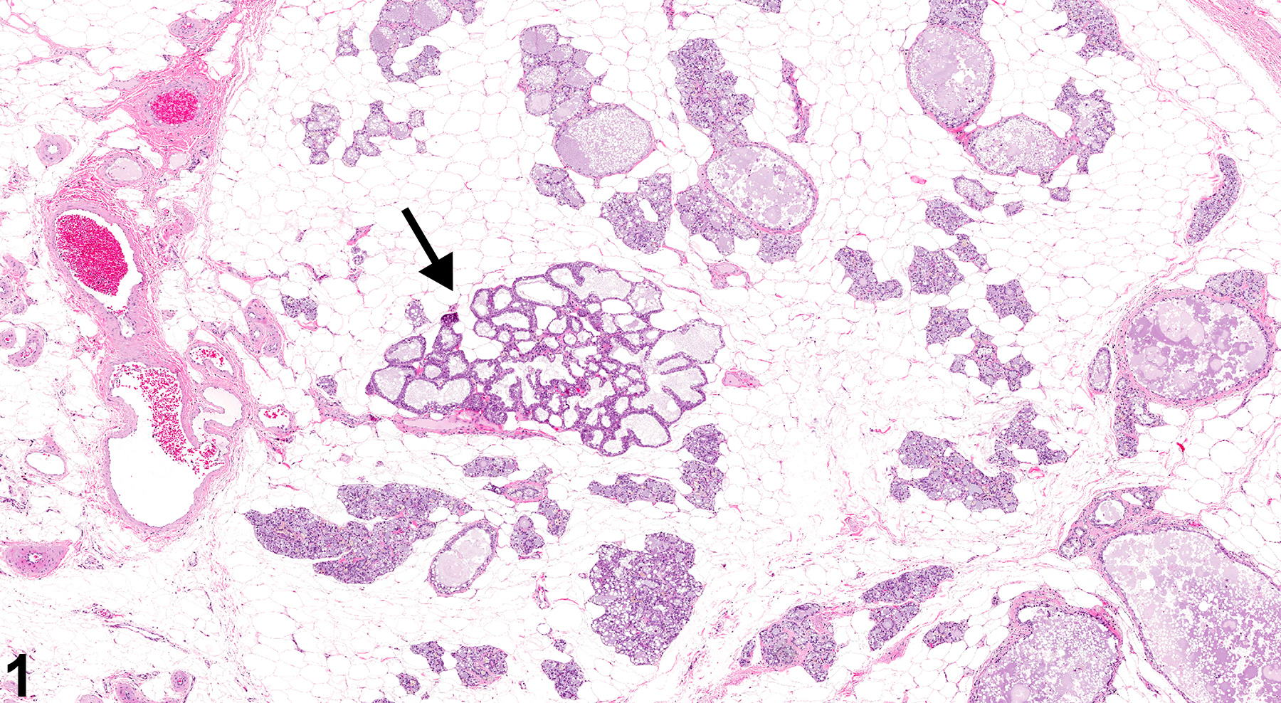 Image of atypical hyperplasia an a female F344/N rat from a chronic study.