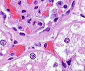 Nonneoplastic Lession Atlas icon