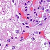 Microscope image of rodent liver tissue