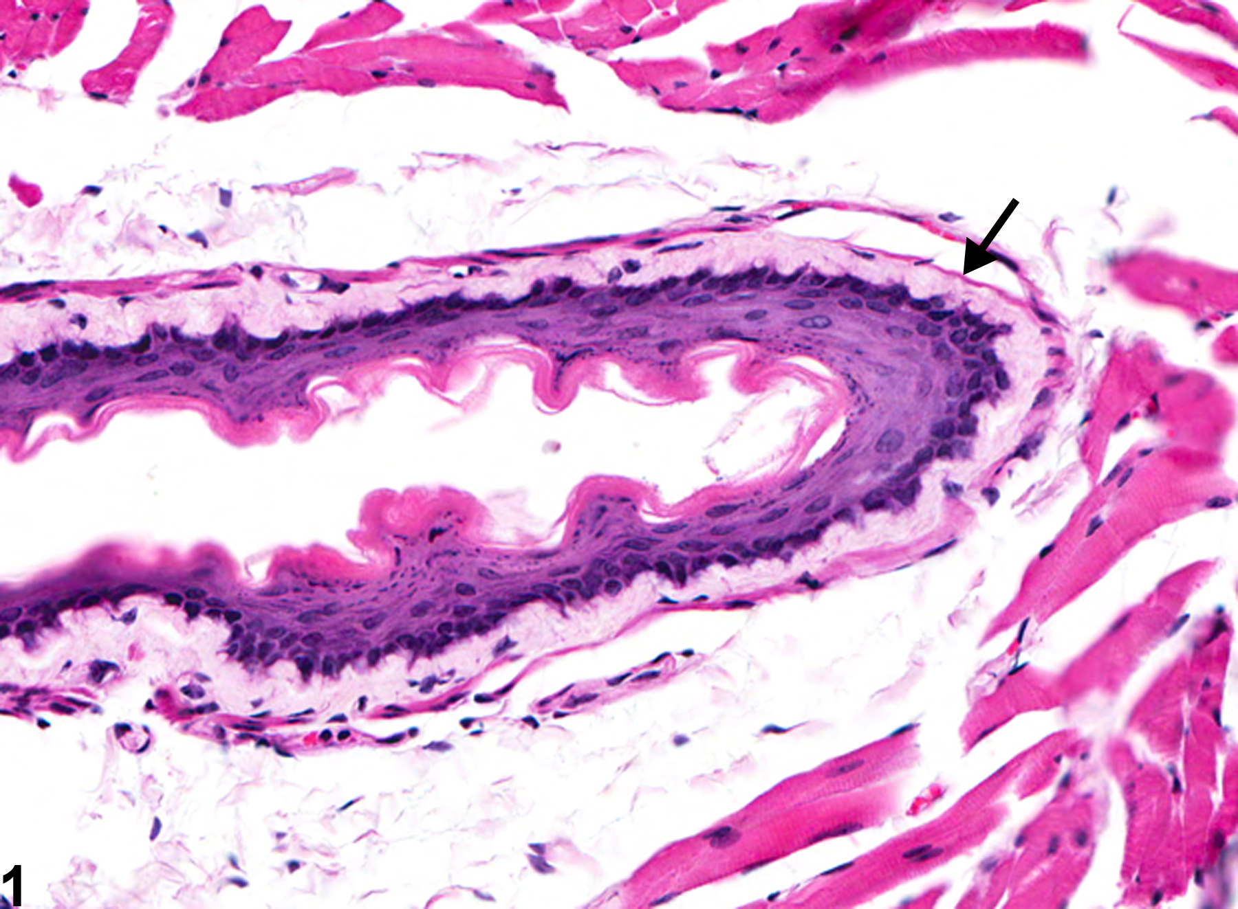 Image of amyloid in the esophagus from a male Swiss Webster mouse in a chronic study