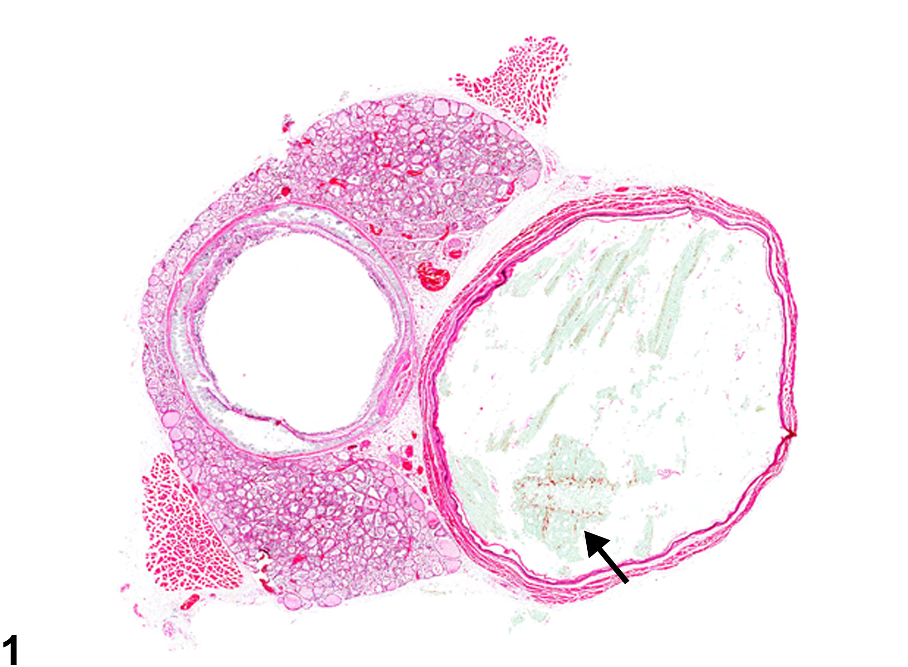 Image of dilation in the esophagus from a male Wistar Han rat in a chronic study