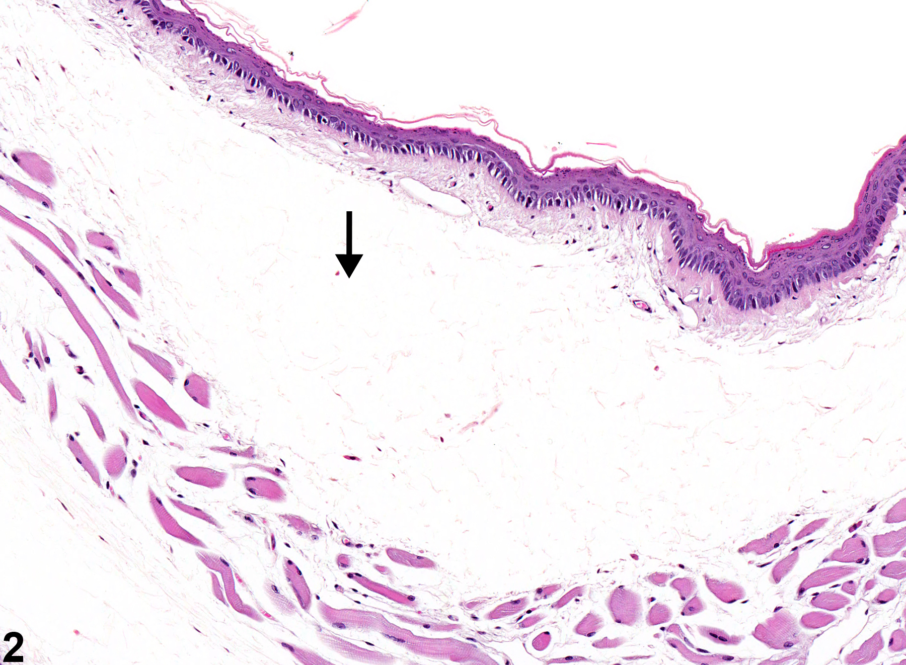 Image of edema in the esophagus from a male B6C3F1 mouse in a chronic study