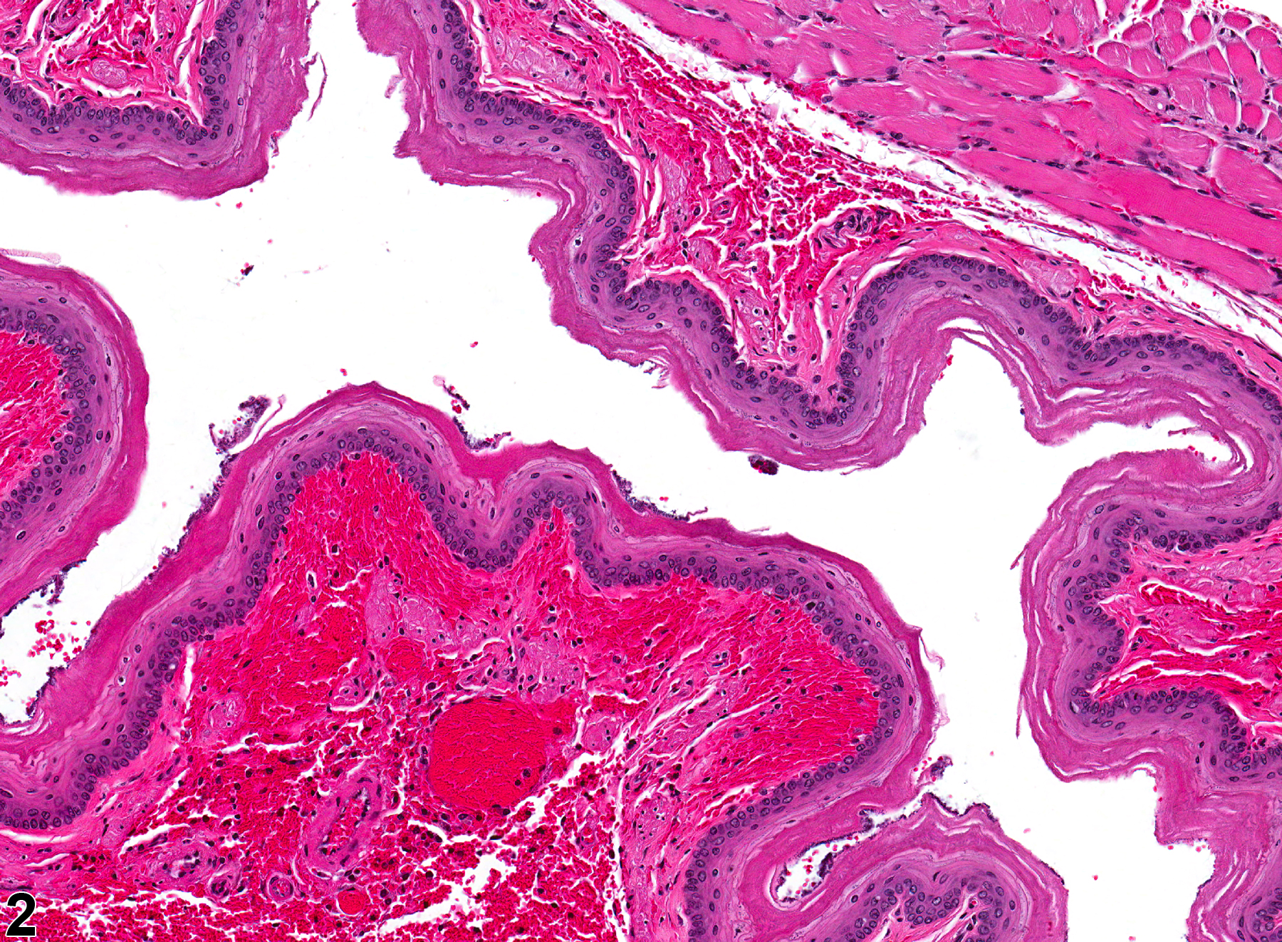 Image of hemorrhage in the esophagus from a male F344/N rat in a chronic study