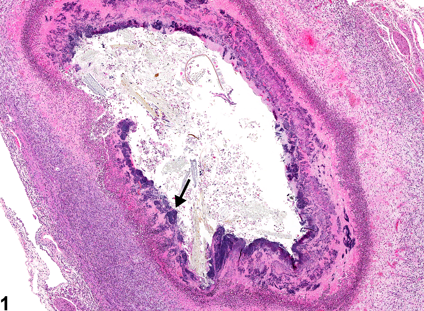 Image of inflammation in the esophagus from a female F344/N rat in a subchronic study
