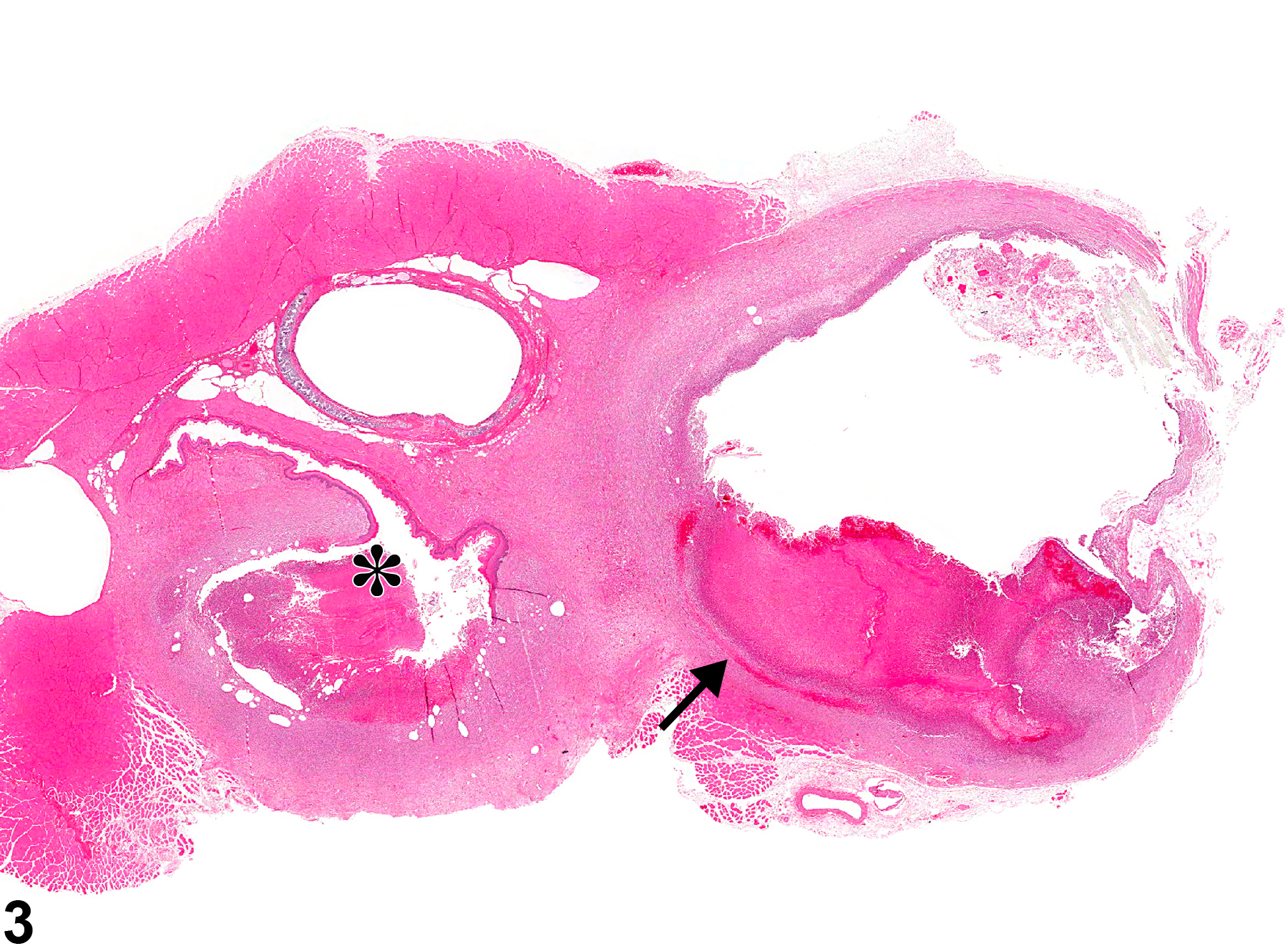Image of inflammation in the esophagus from a male F344/N rat in a chronic study