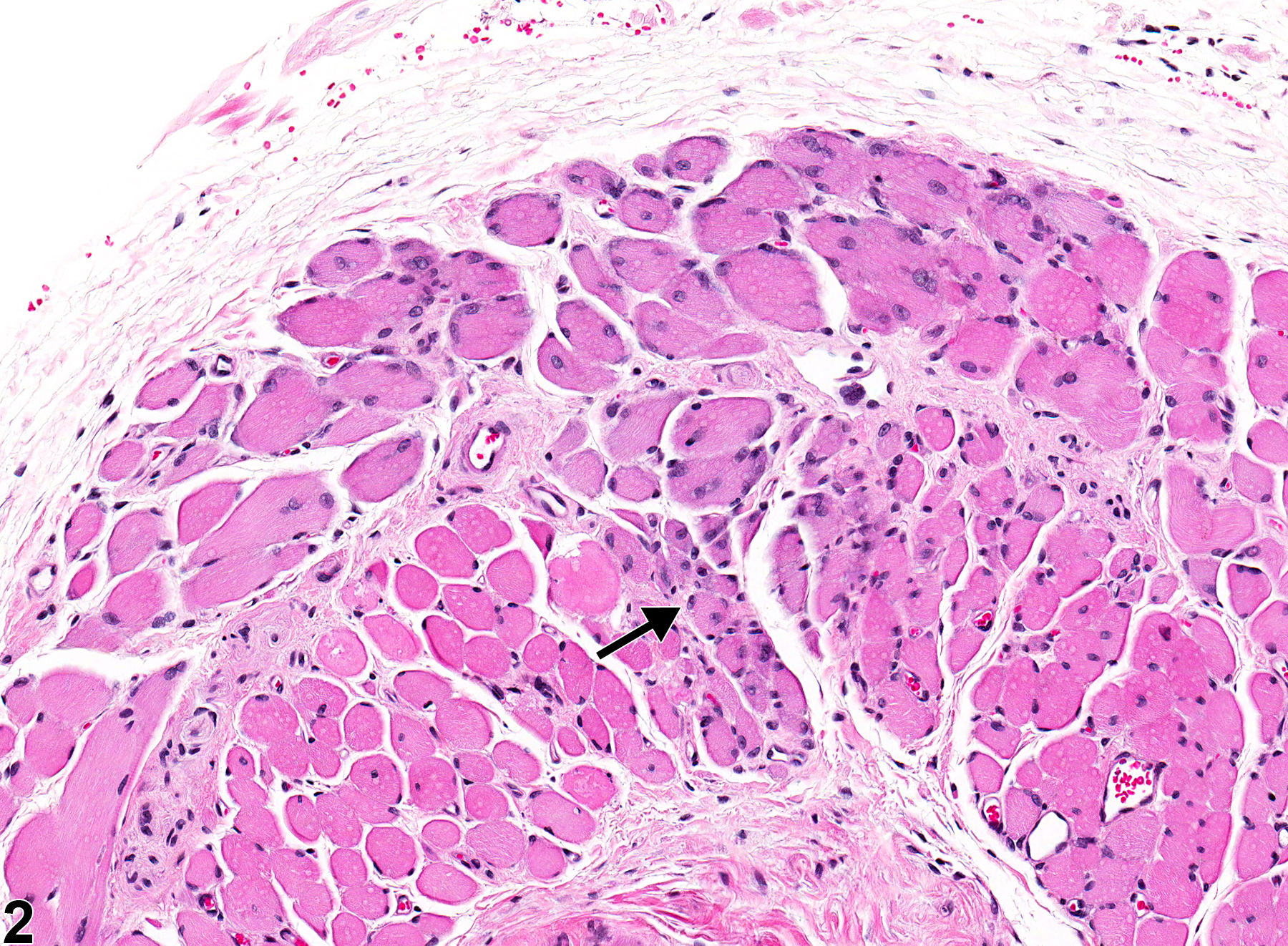 Image of degeneration in the esophagus muscularis from a male F344/N rat in a chronic study
