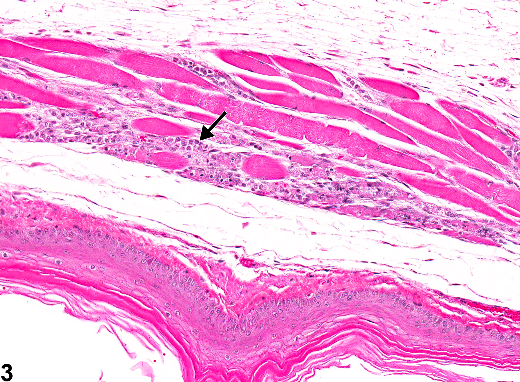 Image of degeneration in the esophagus muscularis from a female Sprague-Dawley rat in a chronic study
