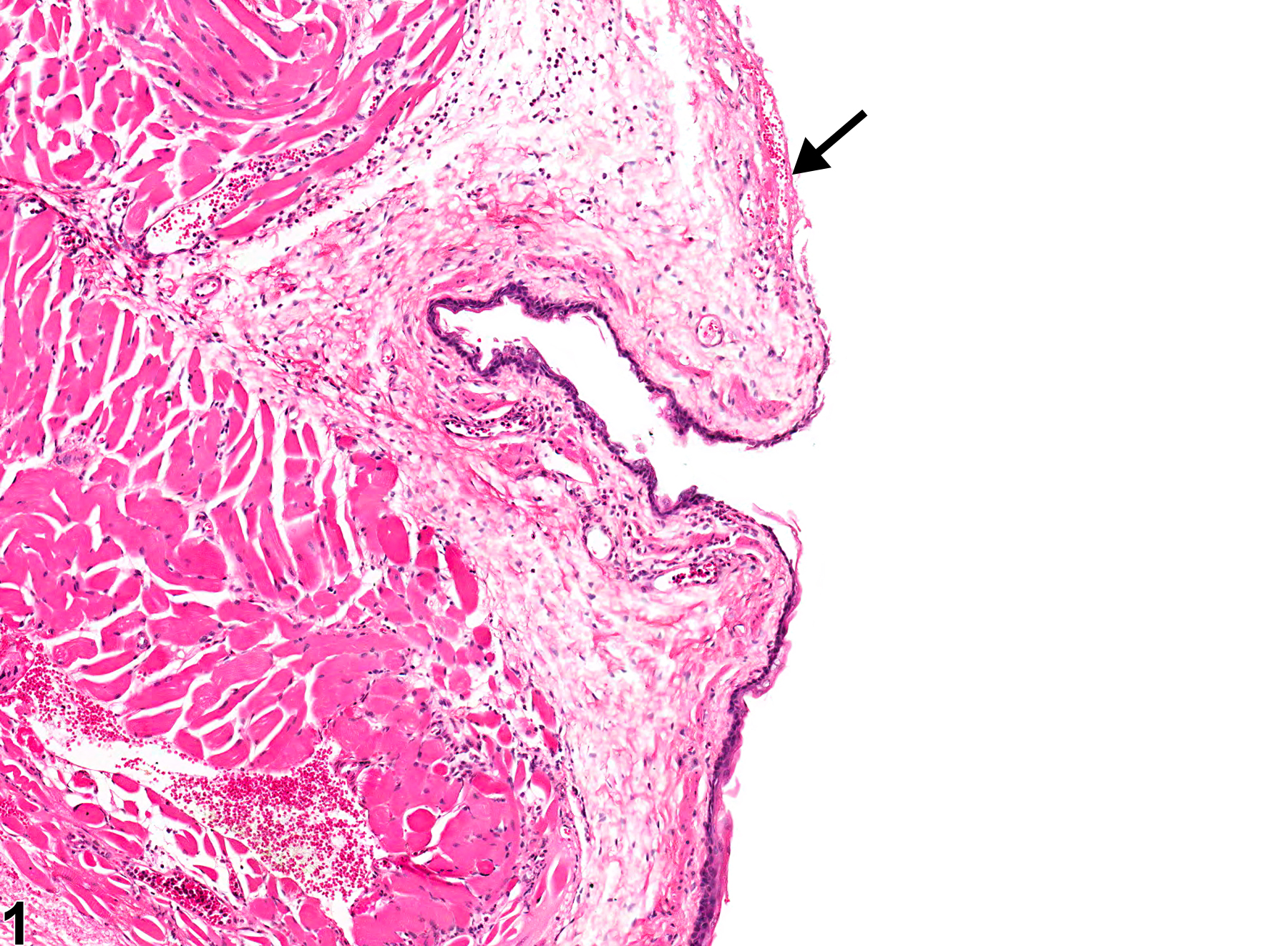 Image of ulcer in the esophagus from a female F344/N rat in a chronic study