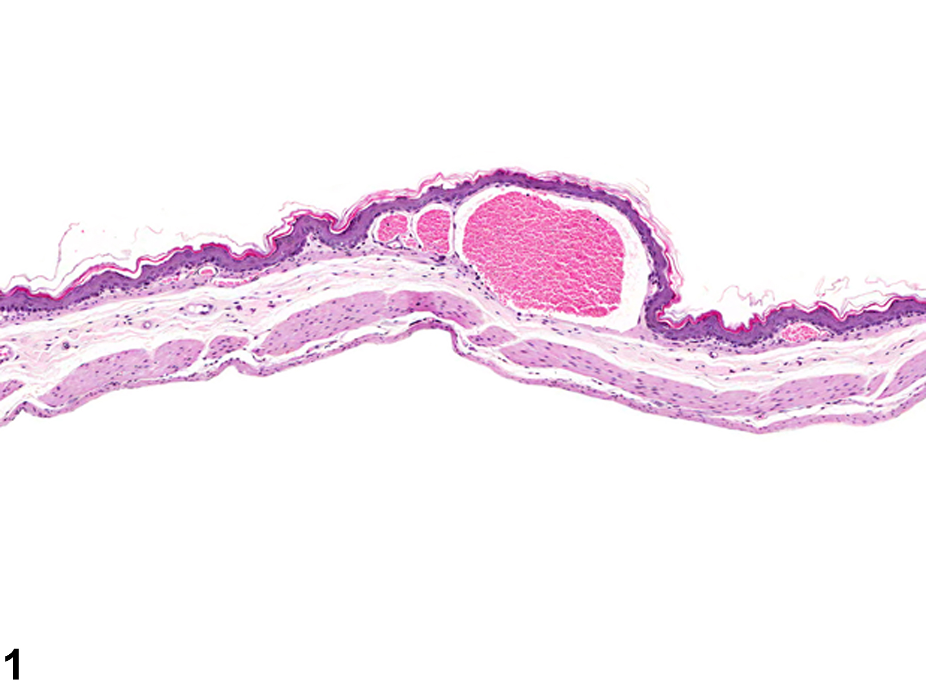 Image of angiectasis in the forestomach from a male B6C3F1 mouse in a chronic study