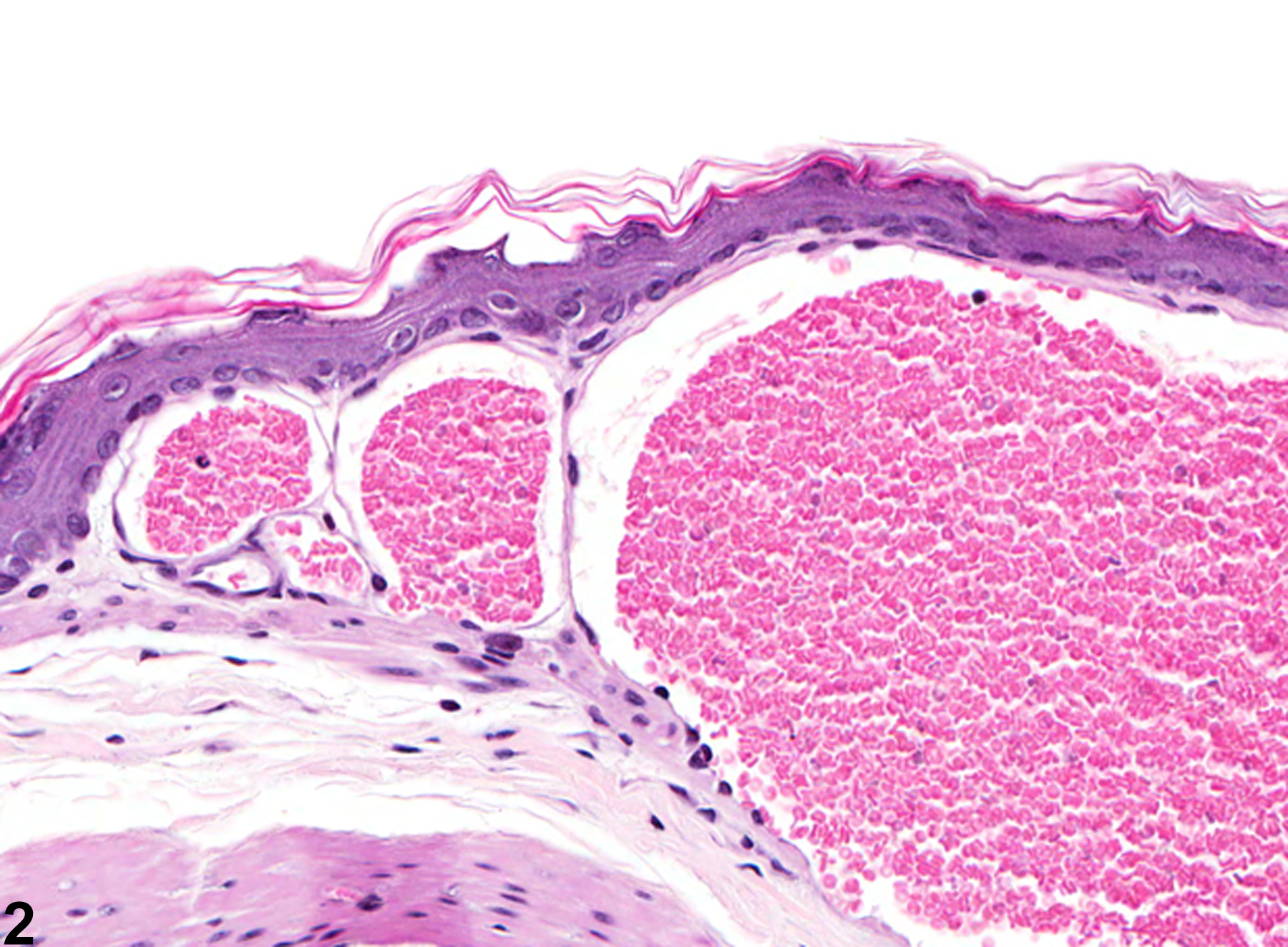 Image of angiectasis in the forestomach from a male B6C3F1 mouse in a chronic study
