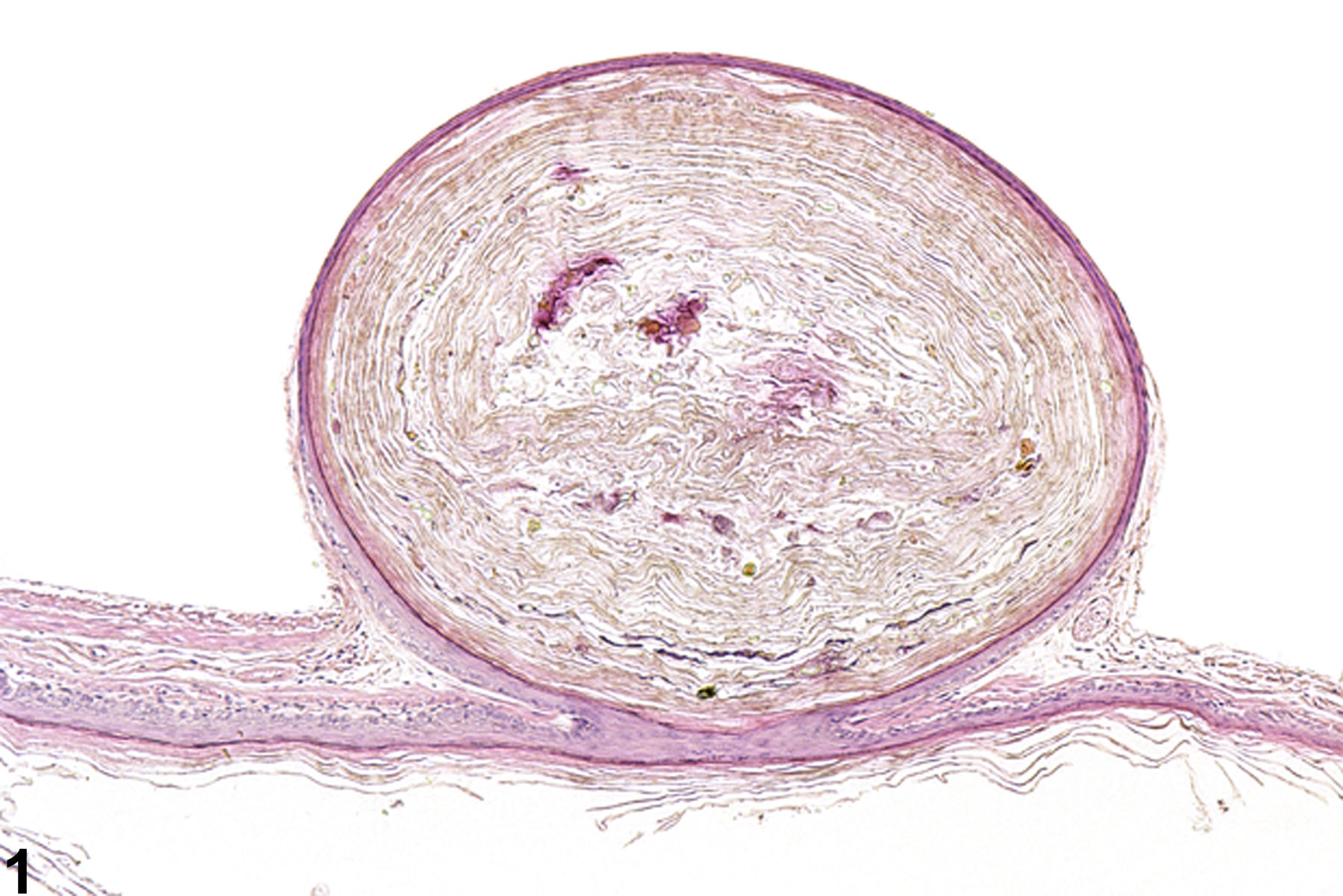 Image of cyst in the forestomach from a male B6C3F1 mouse in a chronic study