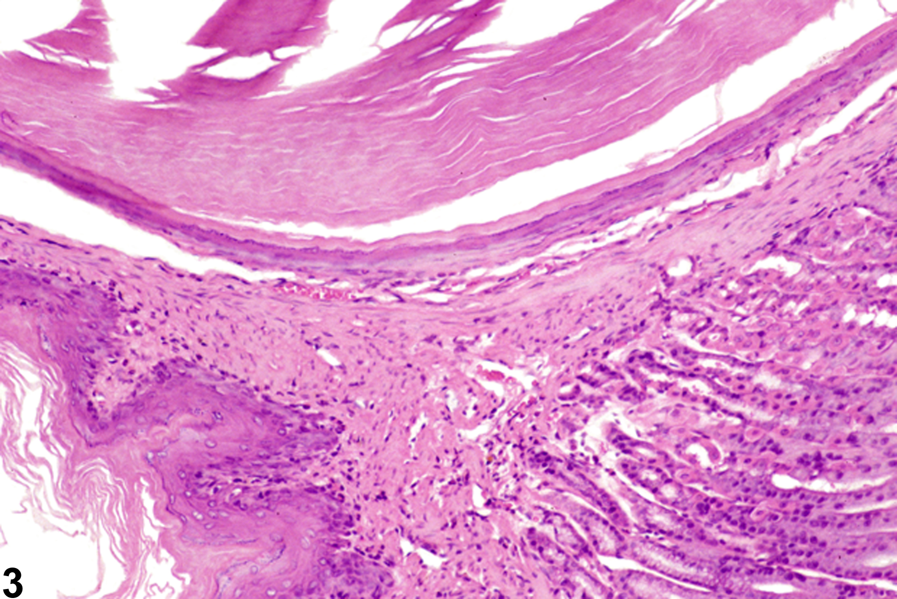 Image of cyst in the forestomach from a female F344/N rat in a chronic study