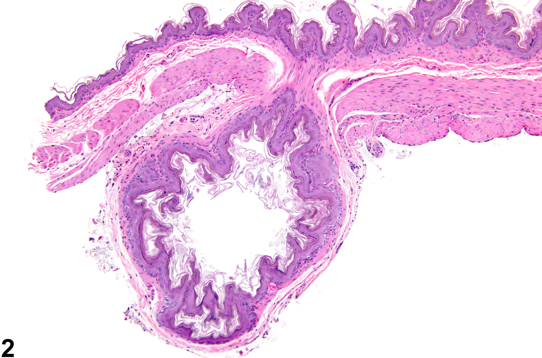 Image of diverticulum in the forestomach from a male B6C3F1 mouse in a chronic study