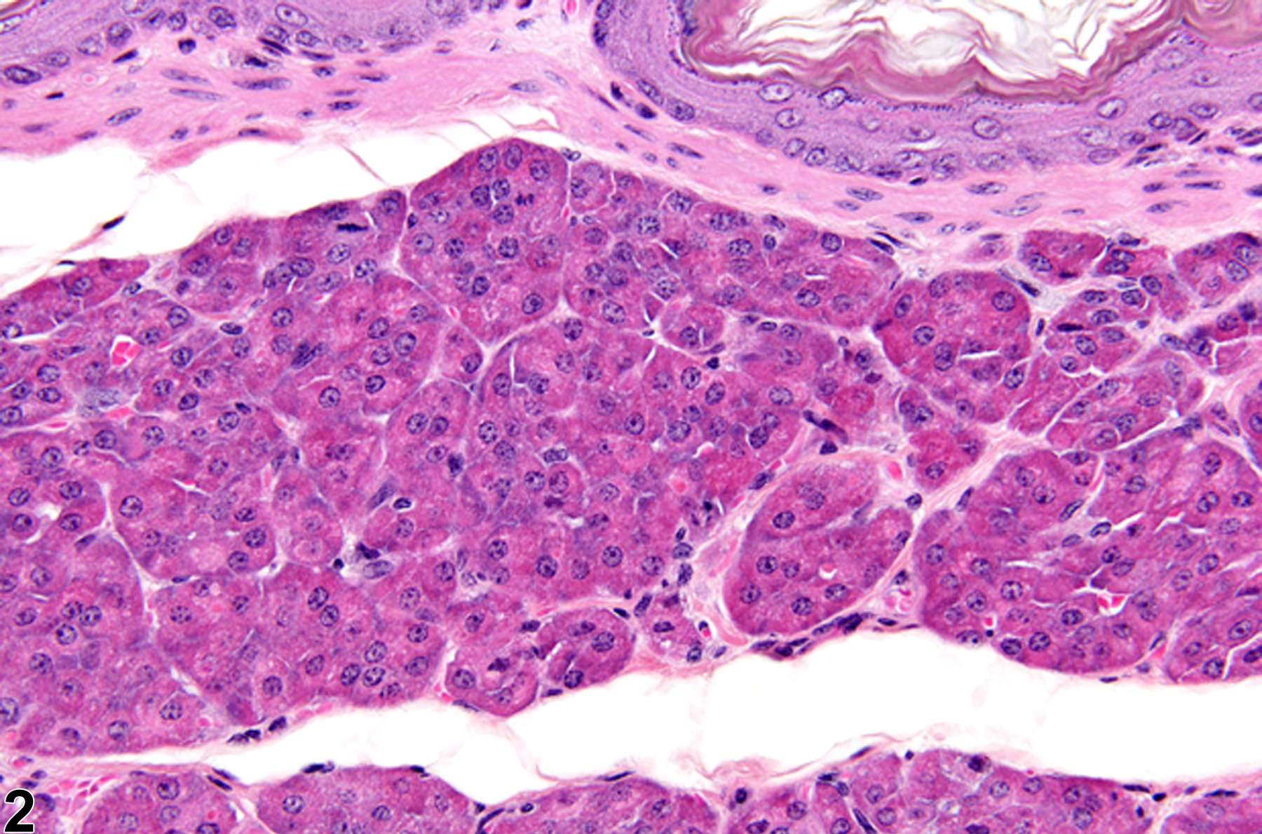 Image of ectopic tissue in the forestomach from a female B6C3F1 mouse in a chronic study