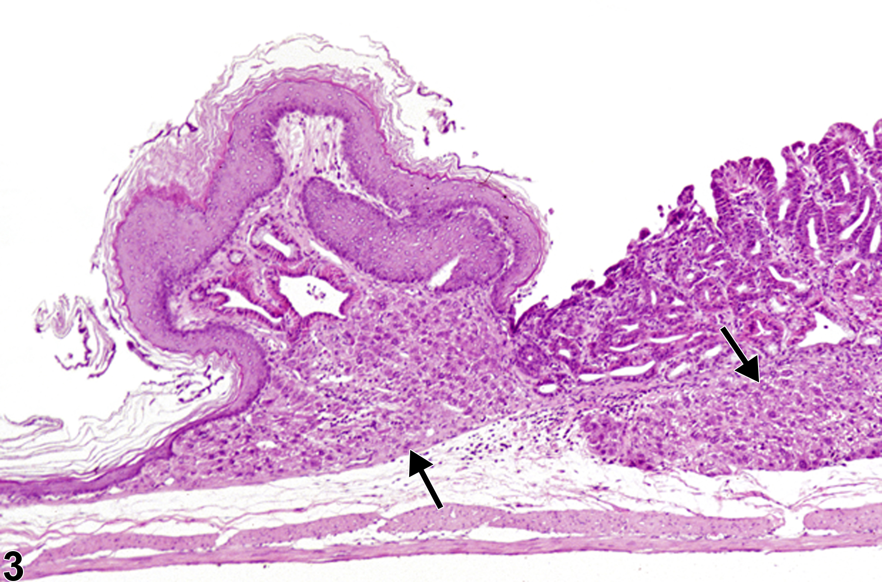 Image of ectopic tissue in the forestomach from a female F344/N rat in a chronic study