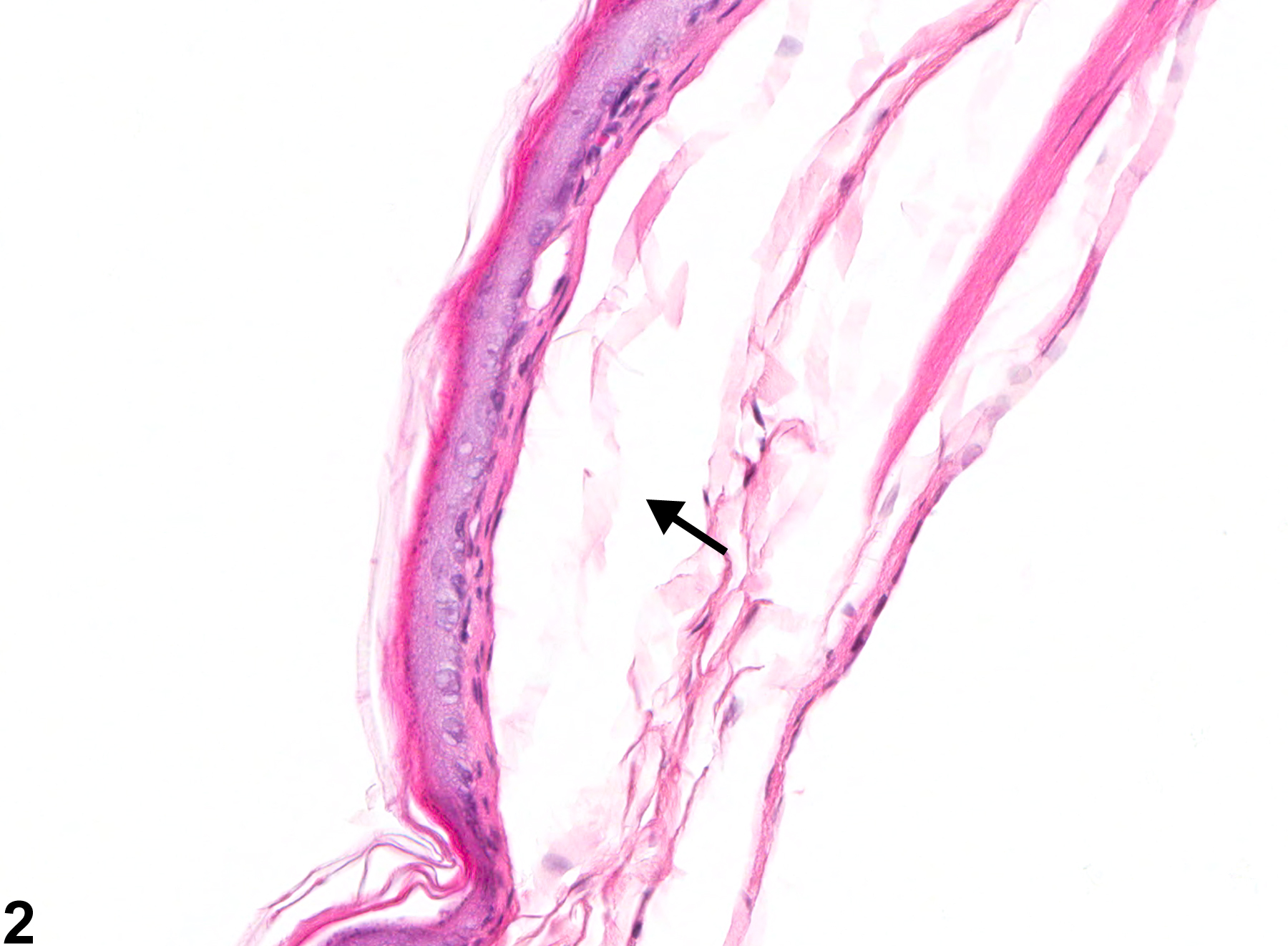 Image of edema in the forestomach from a male F344/N rat in a chronic study