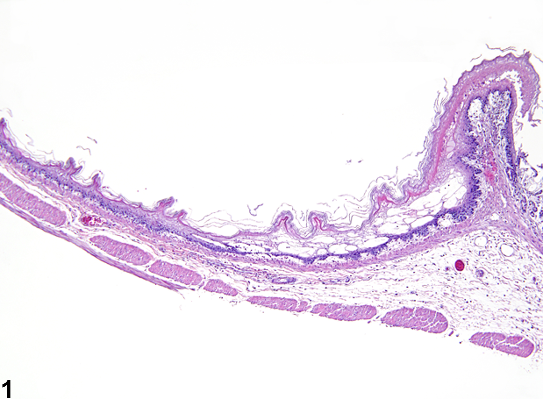 Image of degeneration in the forestomach epithelium from a female F344/N rat in a subchronic study
