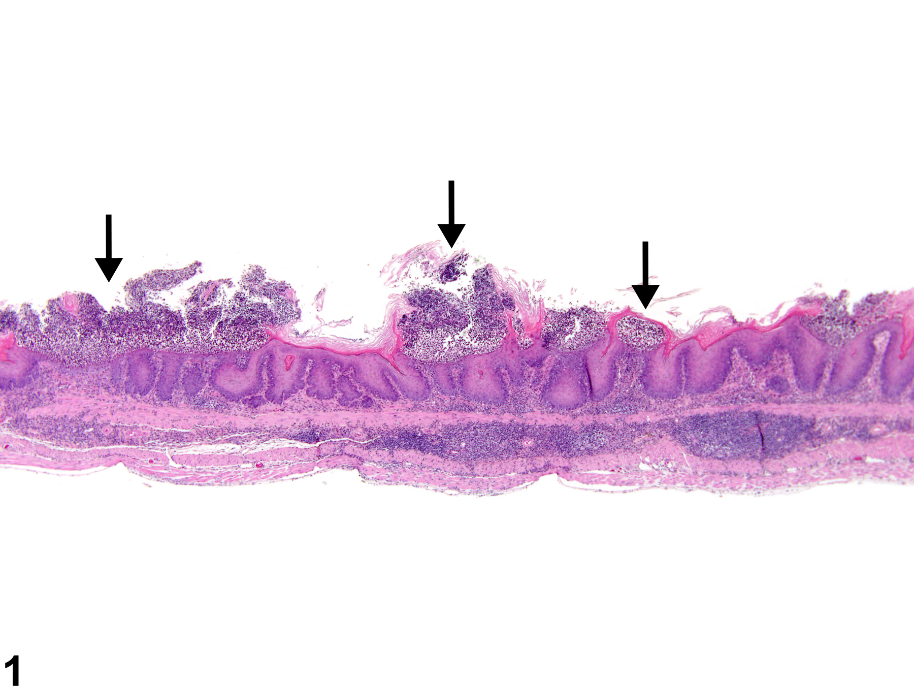 Image of erosion in the forestomach from a female B6C3F1 mouse in a chronic study