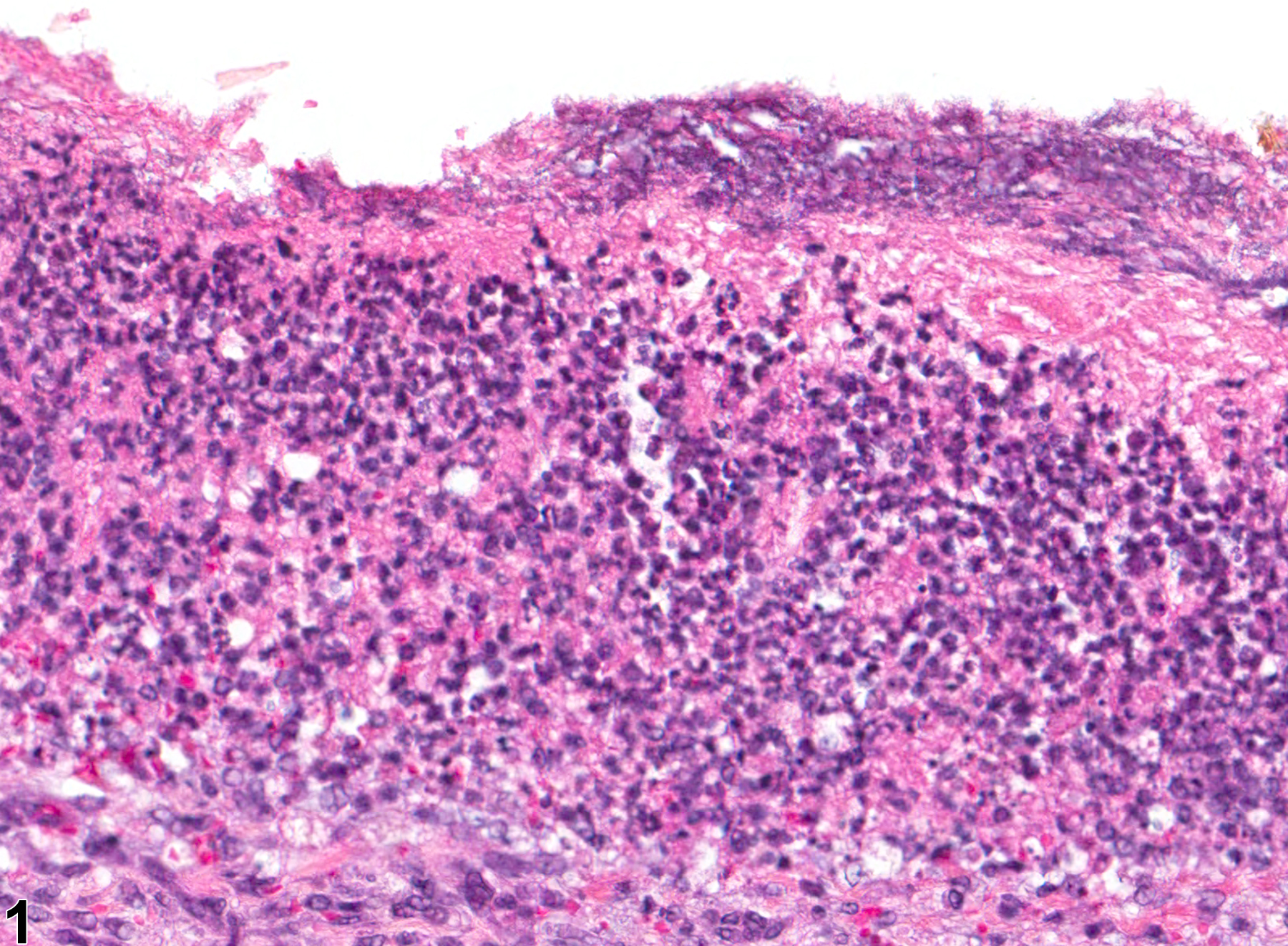 Image of inflammation in the forestomach from a male F344/N rat in a chronic study