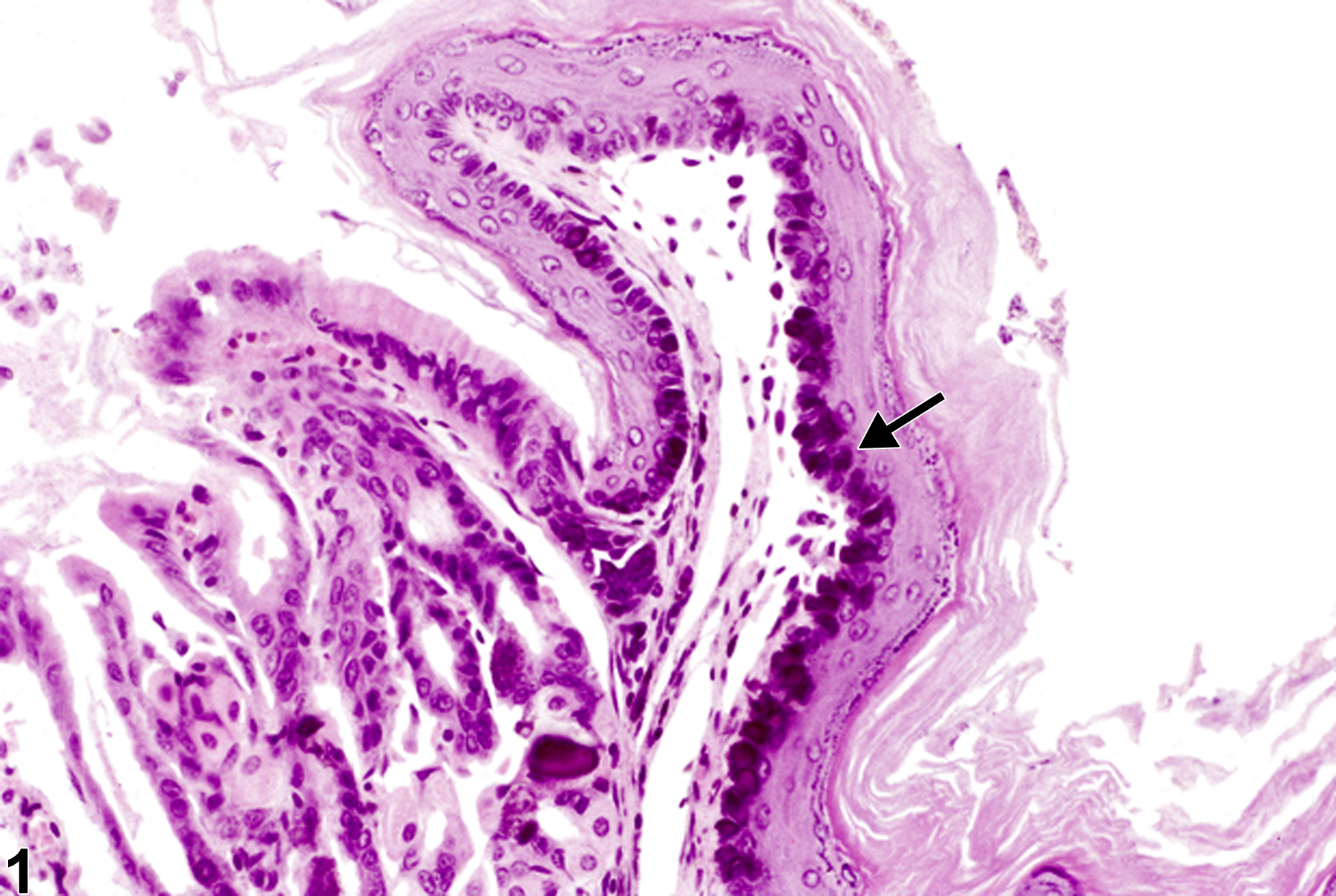 Image of mineralization in the forestomach from a male B6C3F1 mouse in a chronic study