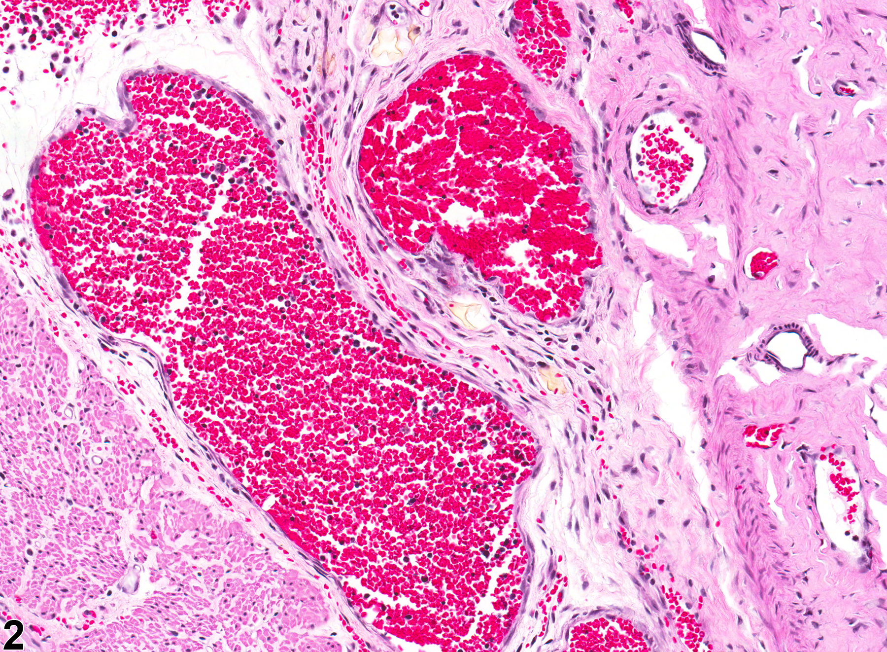 Image of angiectasis in the glandular stomach from a male F344/N rat in a chronic study