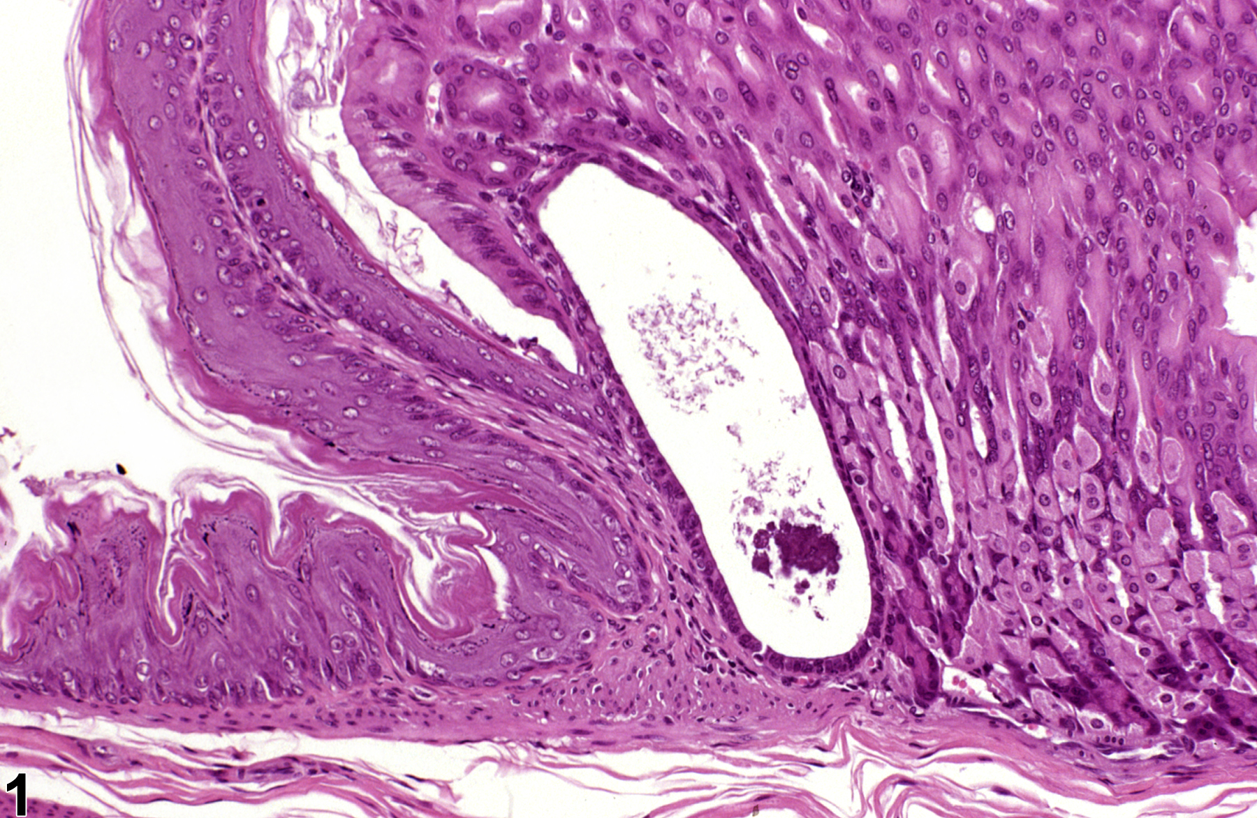 Image of cyst in the glandular stomach glands from a male B6C3F1 mouse in a subchronic study