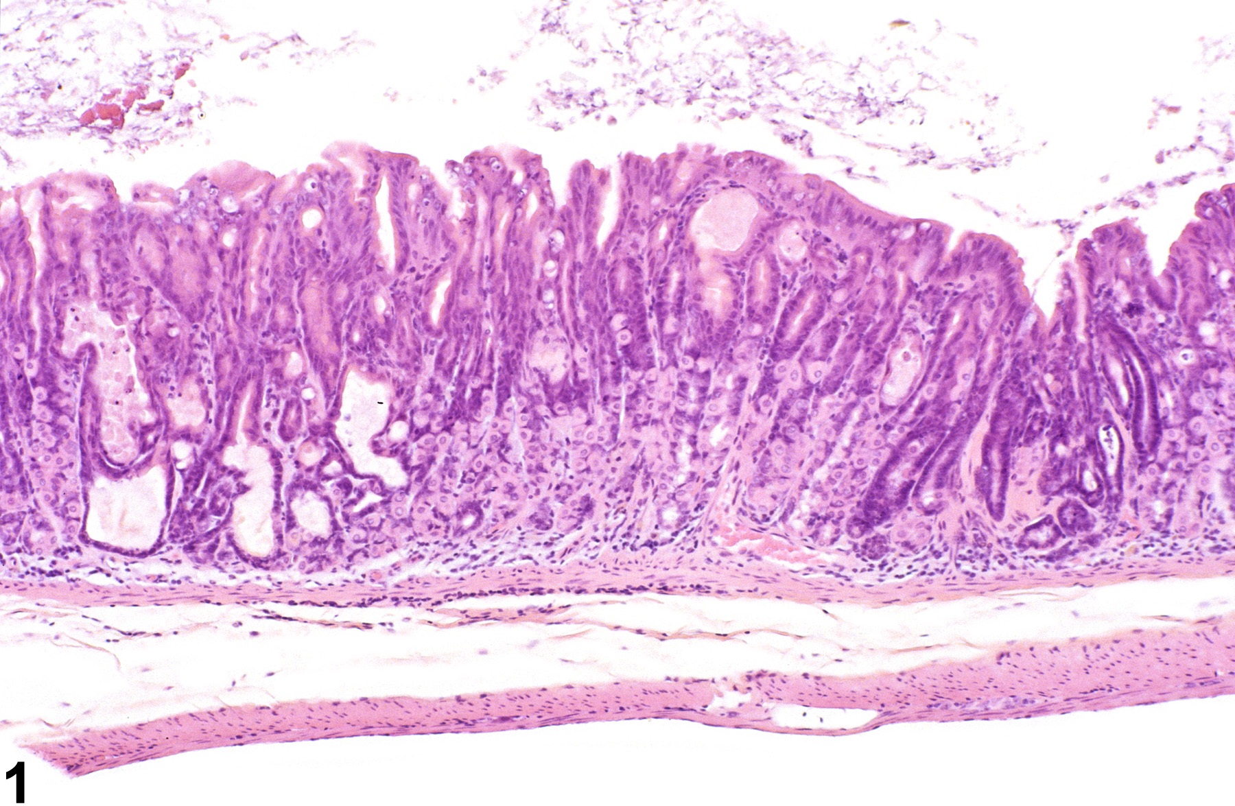 Image of dilation in the glandular stomach glands from a male B6C3F1 mouse in a chronic study